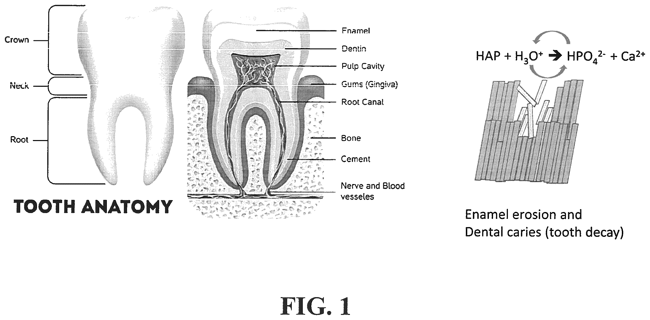Patent US12350353 Figure 1 – Synthetic enamel and uses thereof