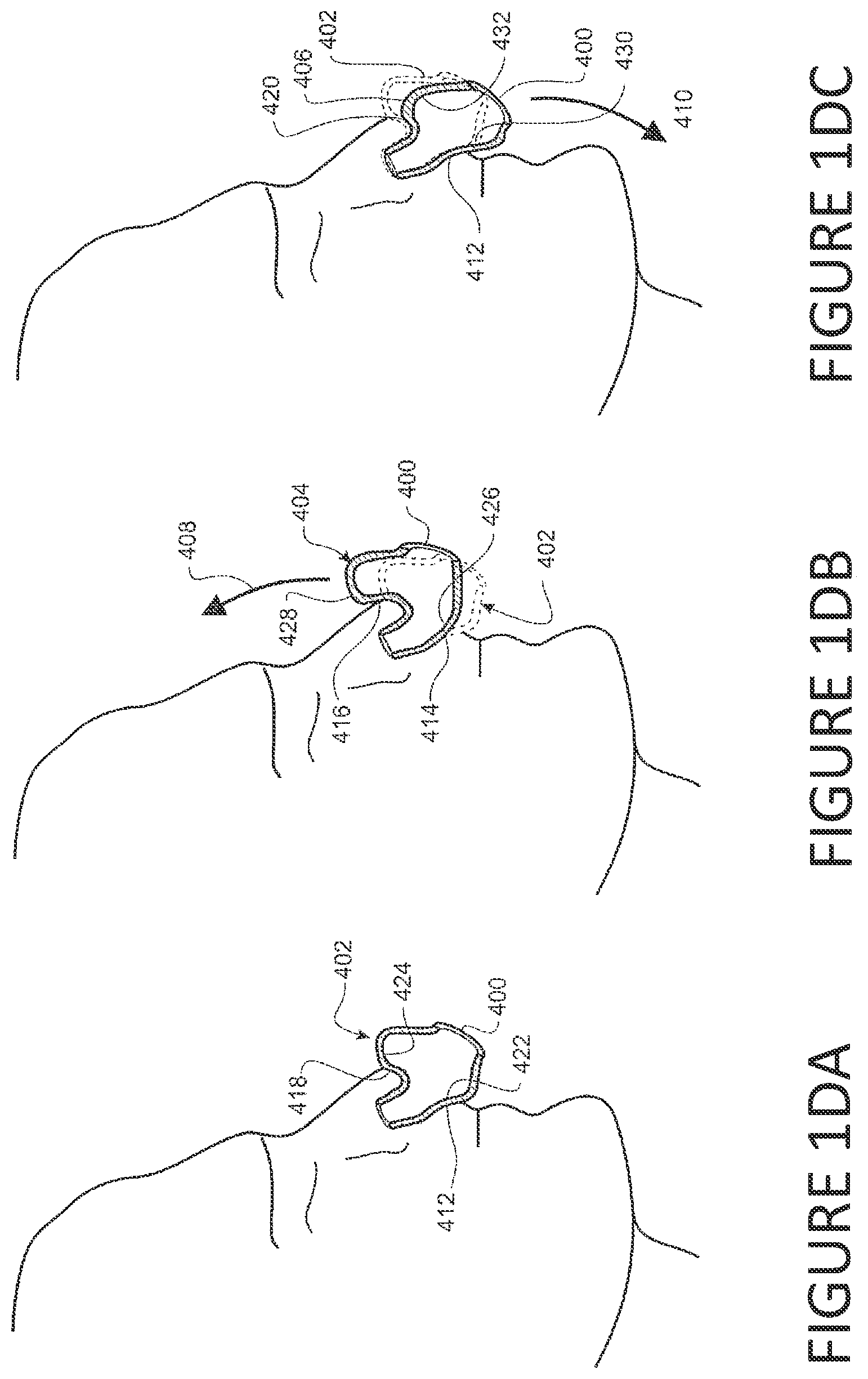 Patent US12350432 Figure 4 – Frame with supporting arms and length adjustable strap