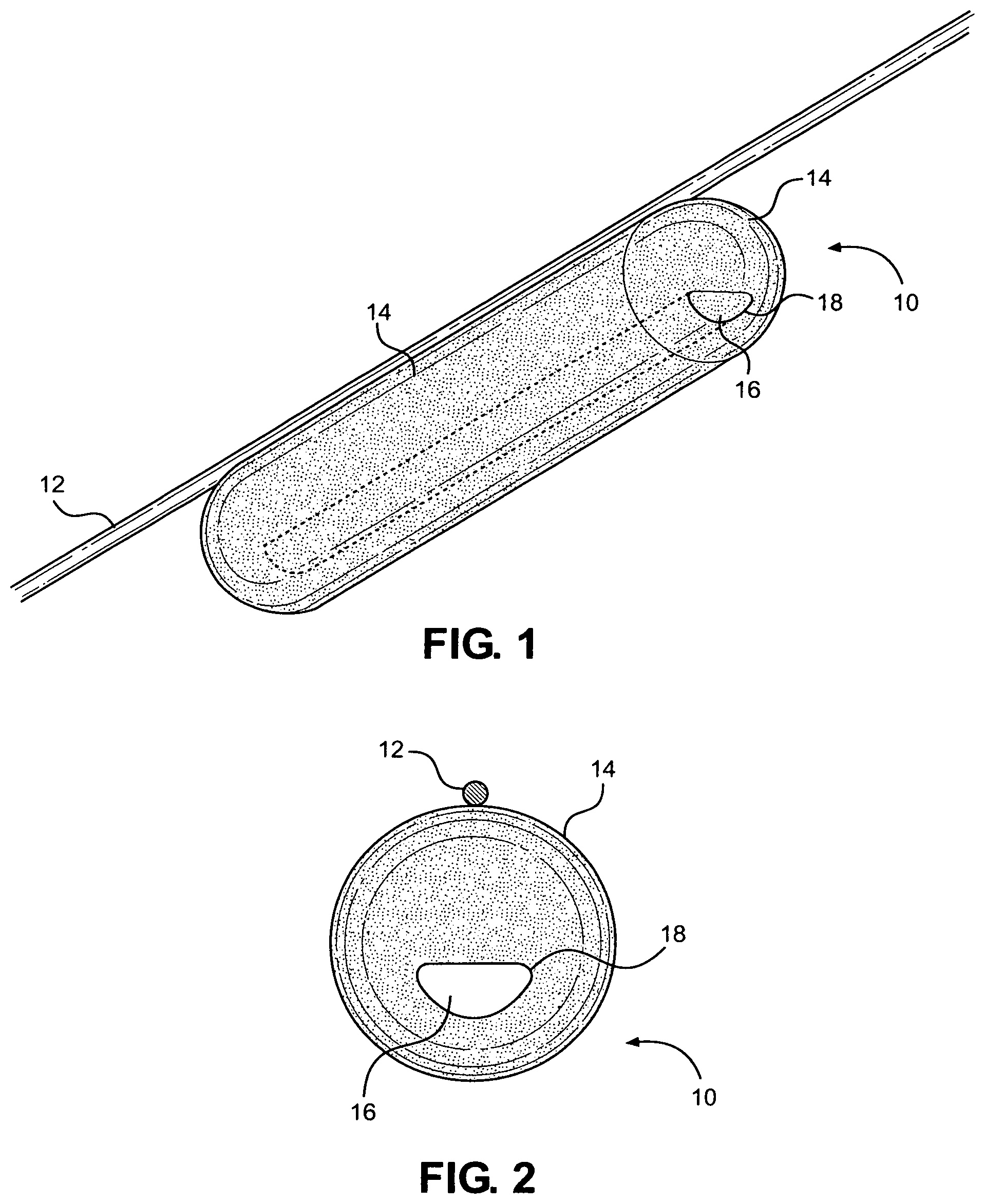 Patent US12350455 — Angioplasty balloon snare — Figure 1