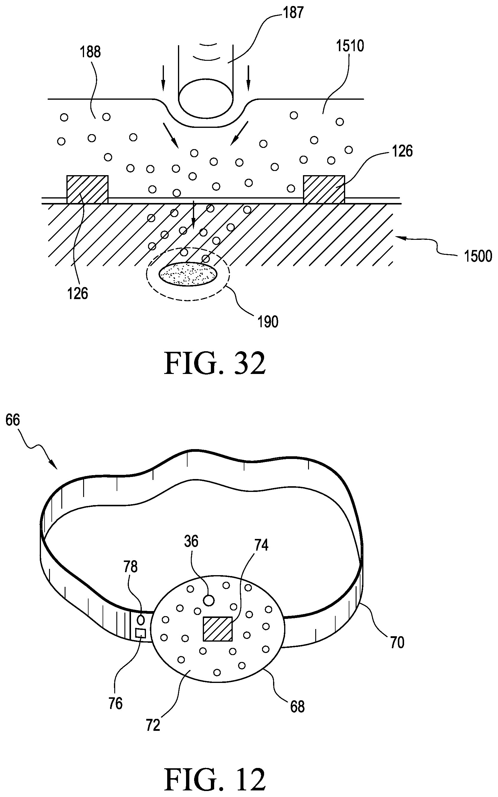 Patent US12350458 Figure 17 – Apparatus and method for skin treatment