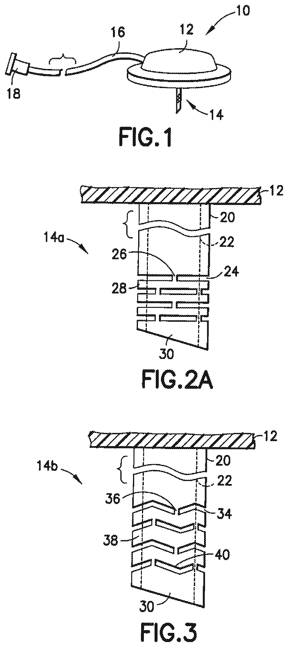 Patent US12350465 — Infusion set and/or patch pump having at least one of an in-dwelling rigid catheter with flexible features and/or a flexible catheter attachment — Figure 1