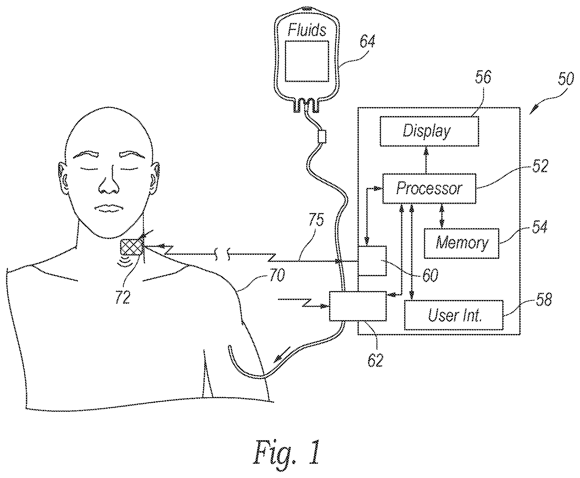 Patent US12350468 Figure 1 – Dynamically controllable patient fluid control device