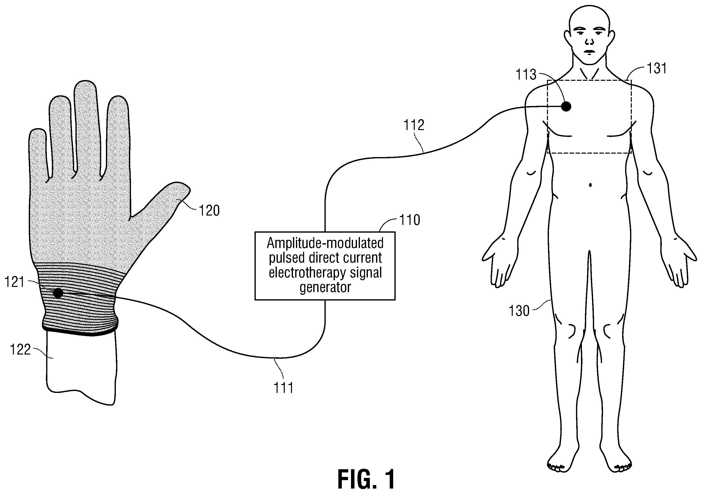 Patent US12350490 — Electrotherapy glove for delivery of amplitude modulated pulsed direct current during manual therapy treatment — Figure 1