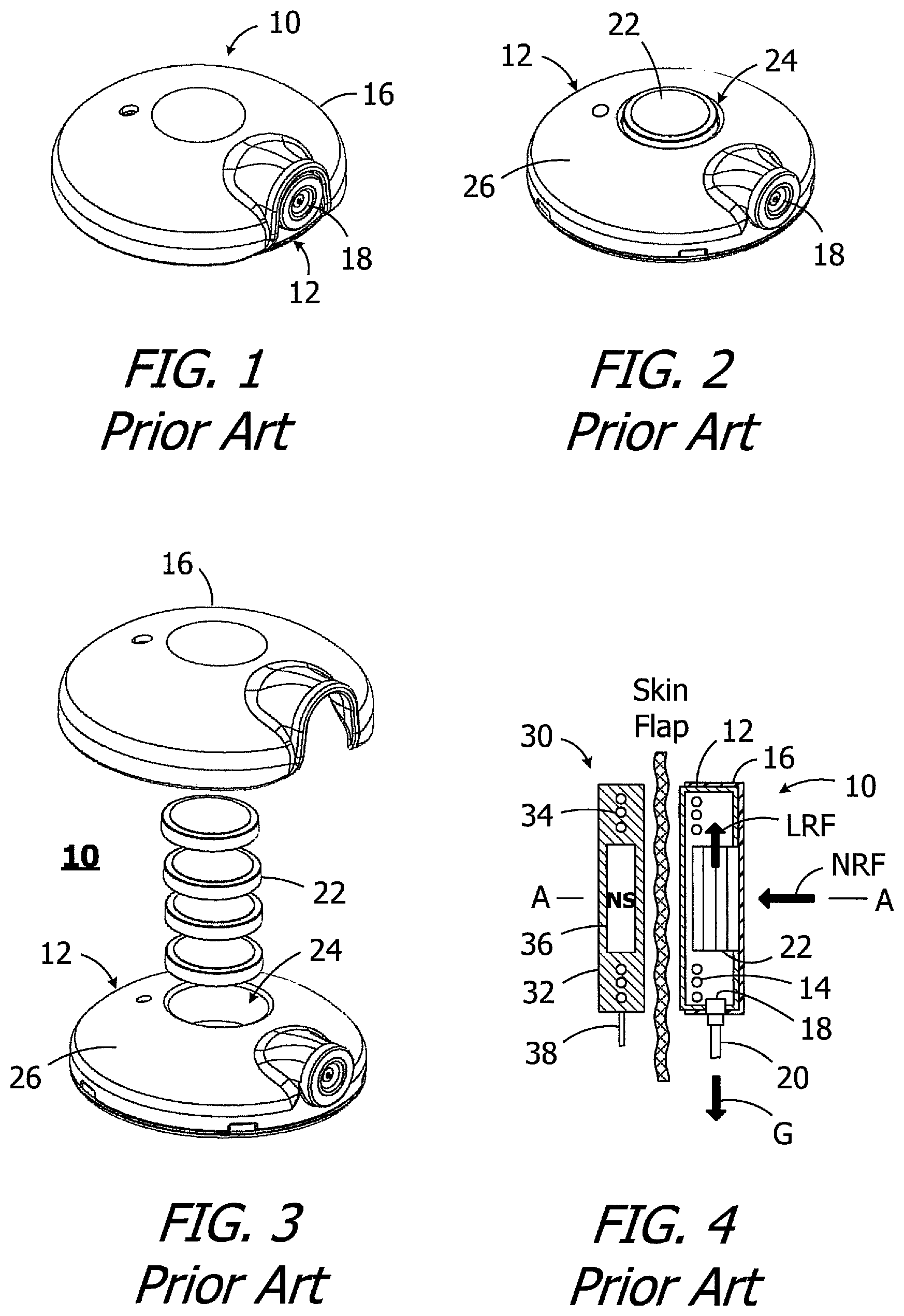 Patent US12350493 — Headpieces and implantable cochlear stimulation systems including the same — Figure 1