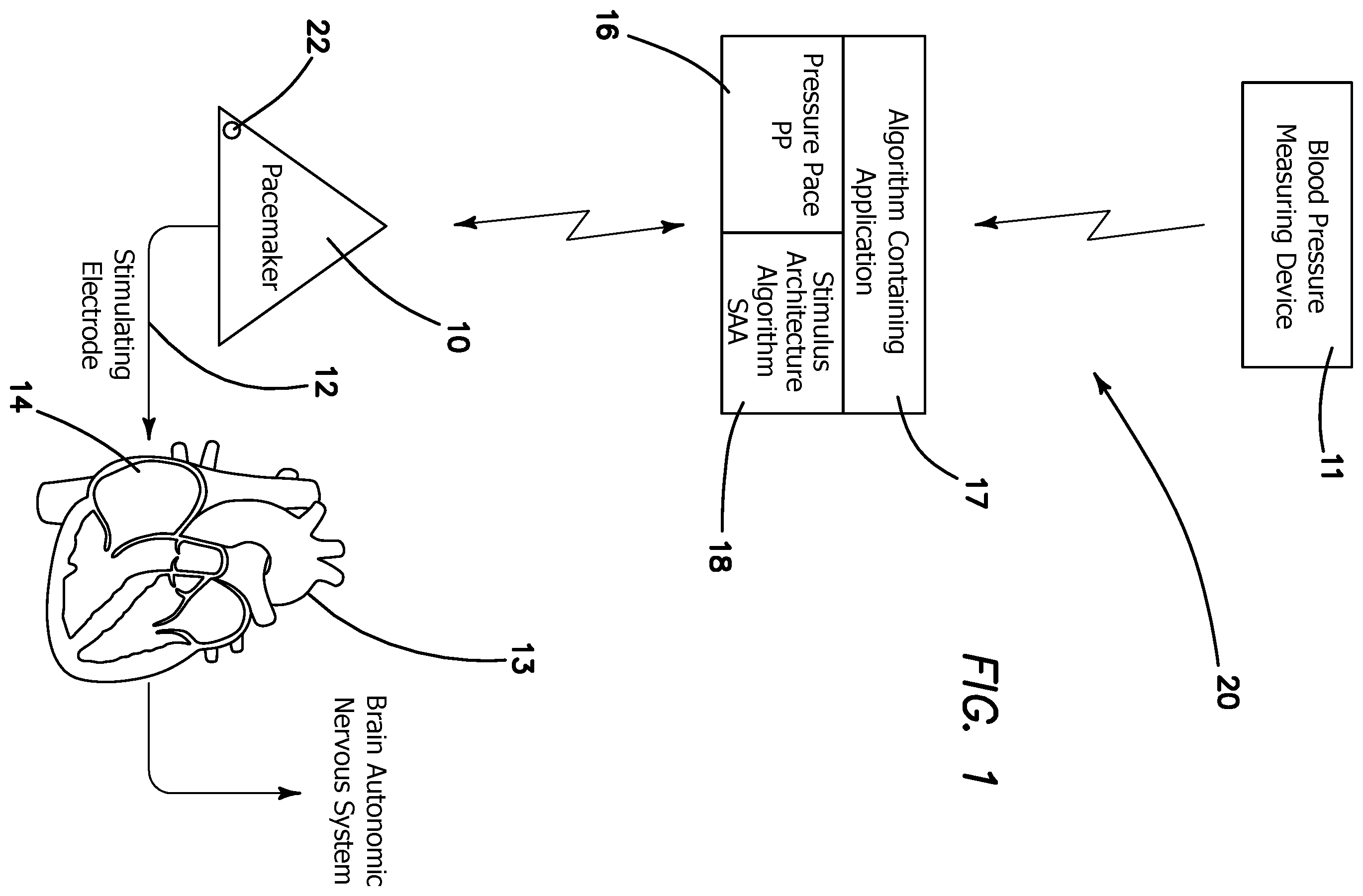 Patent US12350495 — Method of treatment of drug resistant hypertension — Figure 1