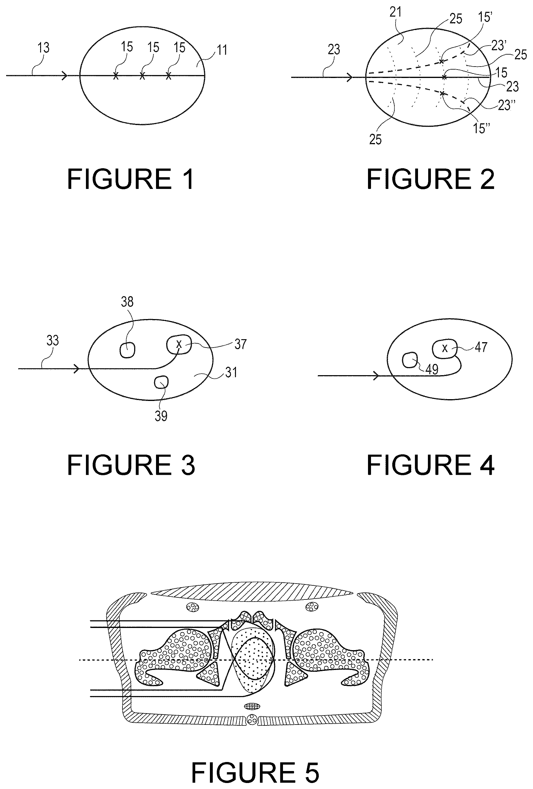 Patent US12350521 — Computer program product and computer system for planning and delivering radiotherapy treatment and a method of planning radiotherapy treatment — Figure 1
