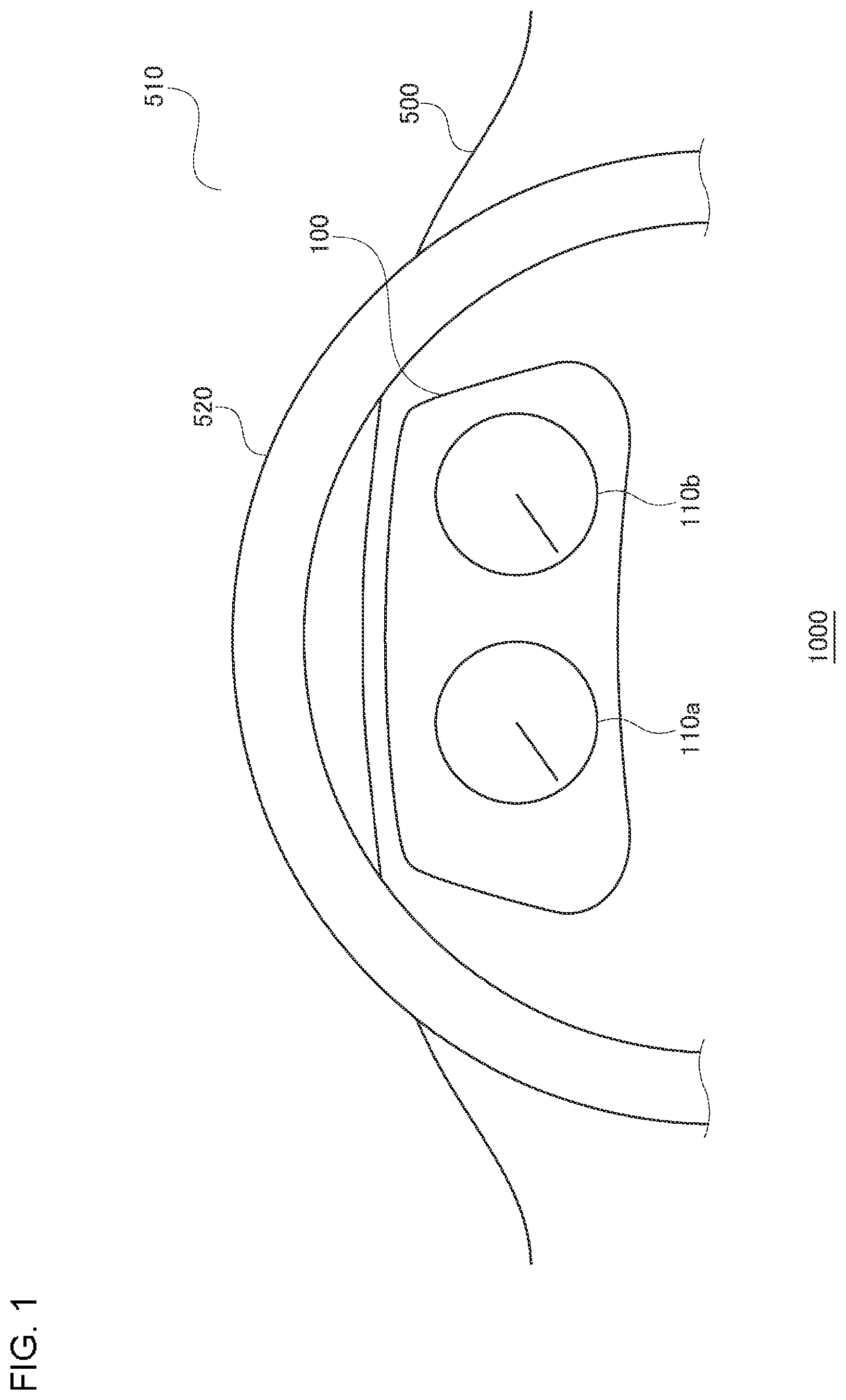 Patent US12351025 — User operation device and in-vehicle device configured for press-down operation — Figure 1