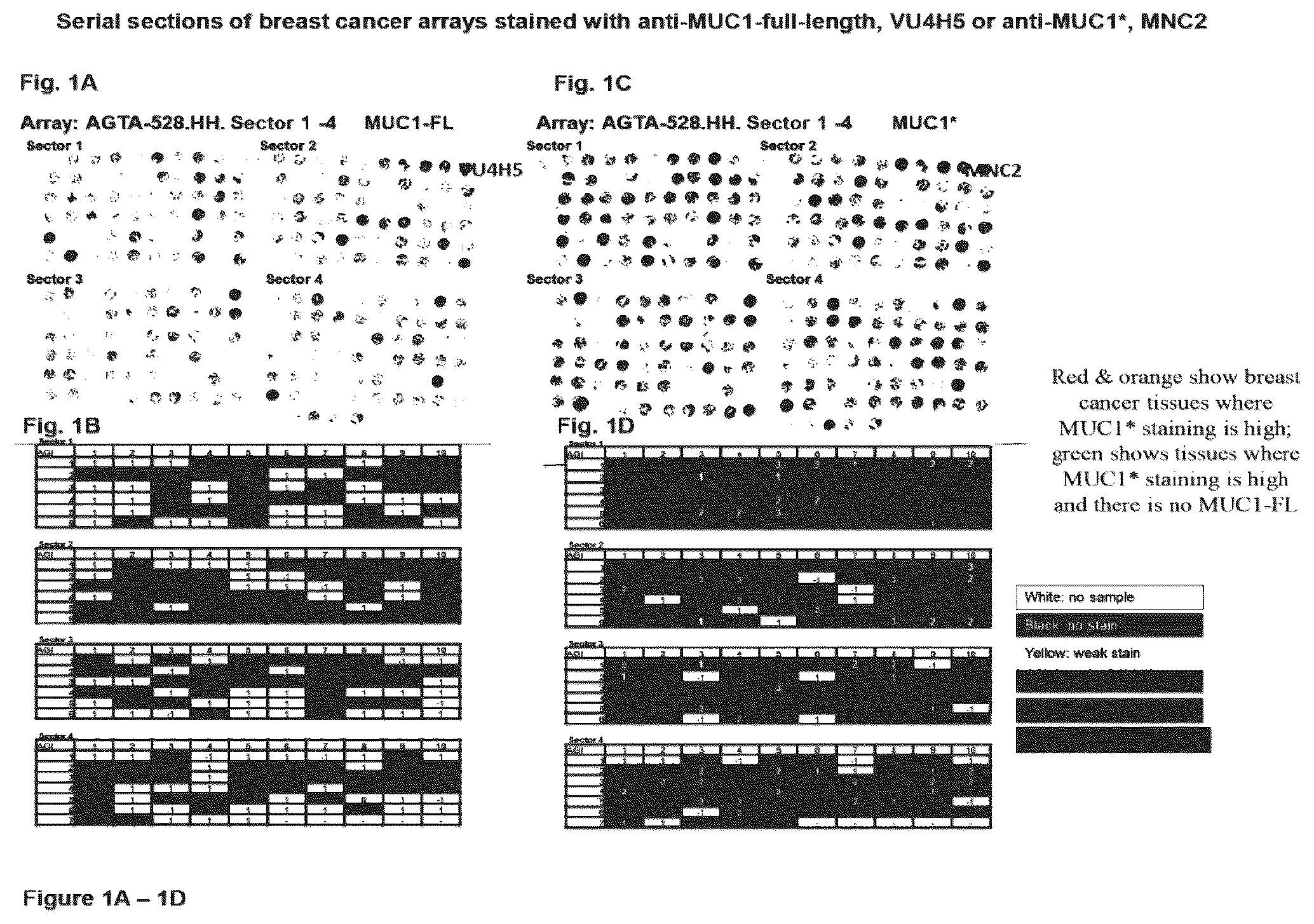 Patent US12351646 — Diagnostic methods using anti-MUC1* antibodies — Figure 1