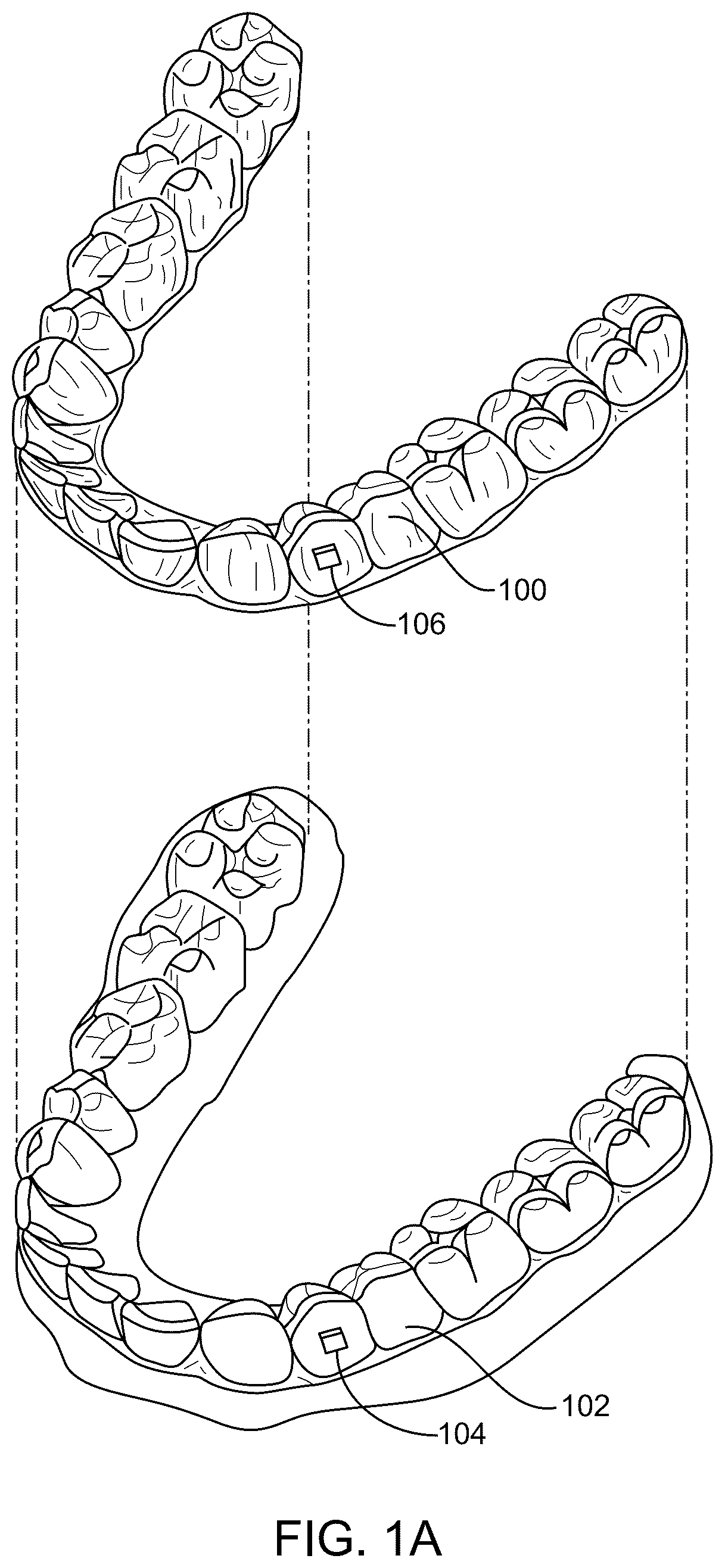 Patent US12351660 — Low viscosity photo-curable resins for the direct fabrication of orthodontic appliances — Figure 1