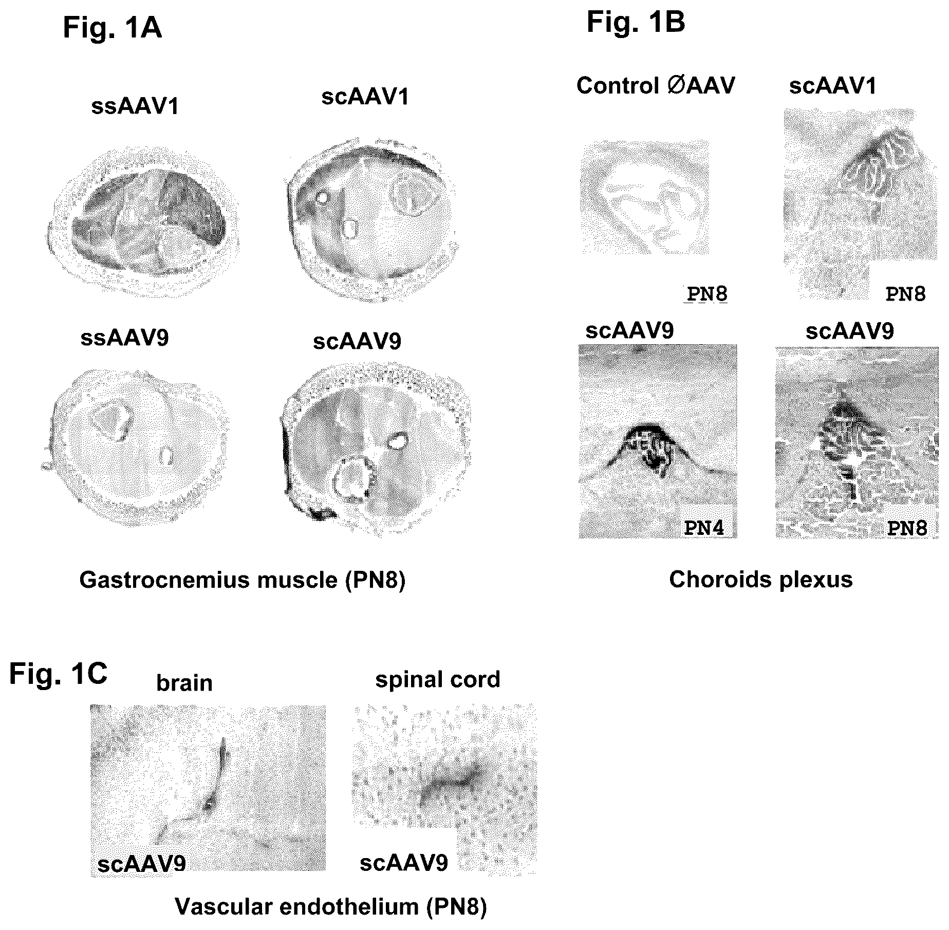 Patent US12351816 — CNS gene delivery using peripheral administration of AAV vectors — Figure 1