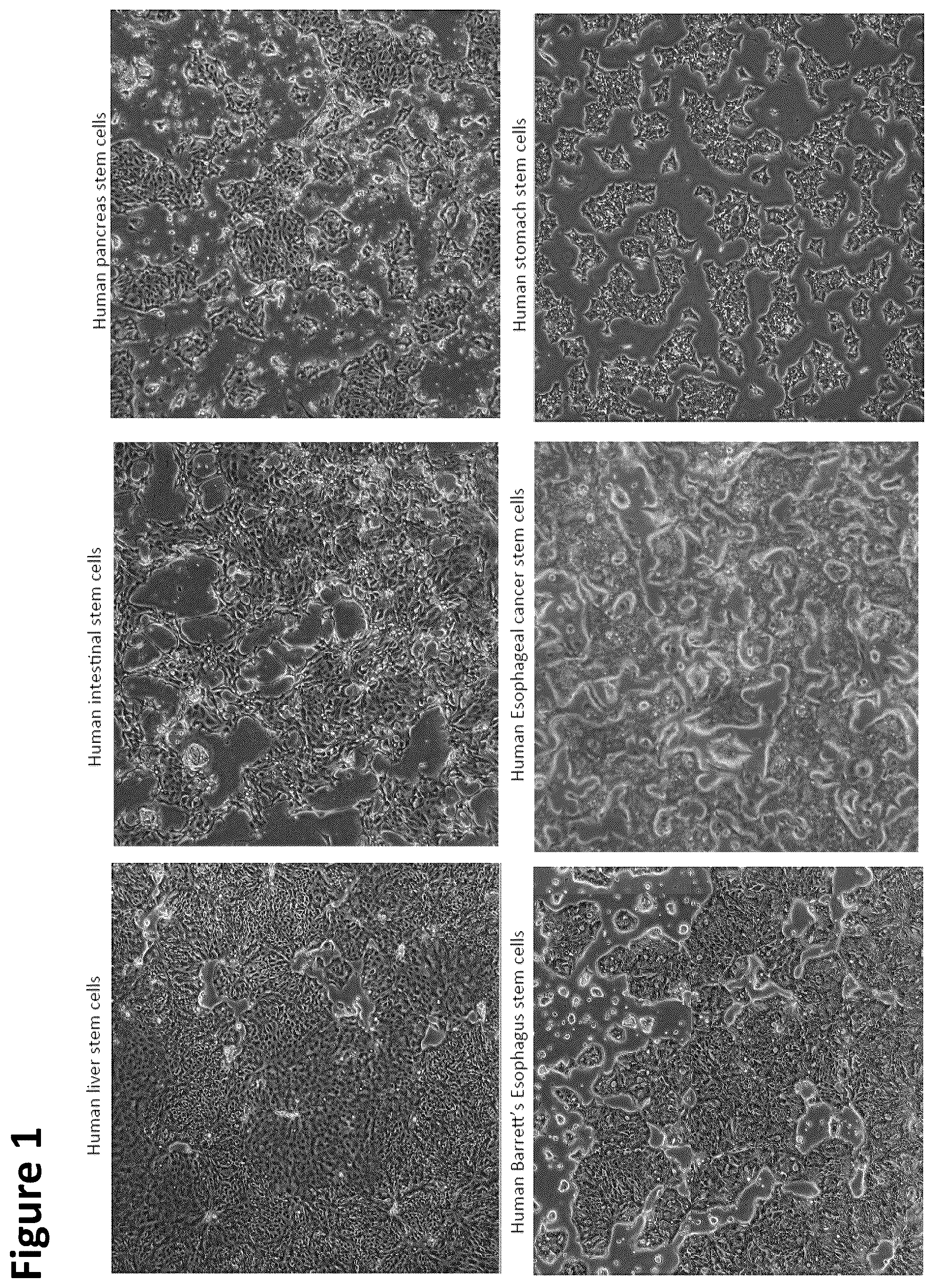 Patent US12351822 — Stem cell culture systems for columnar epithelial stem cells, and uses related thereto — Figure 1