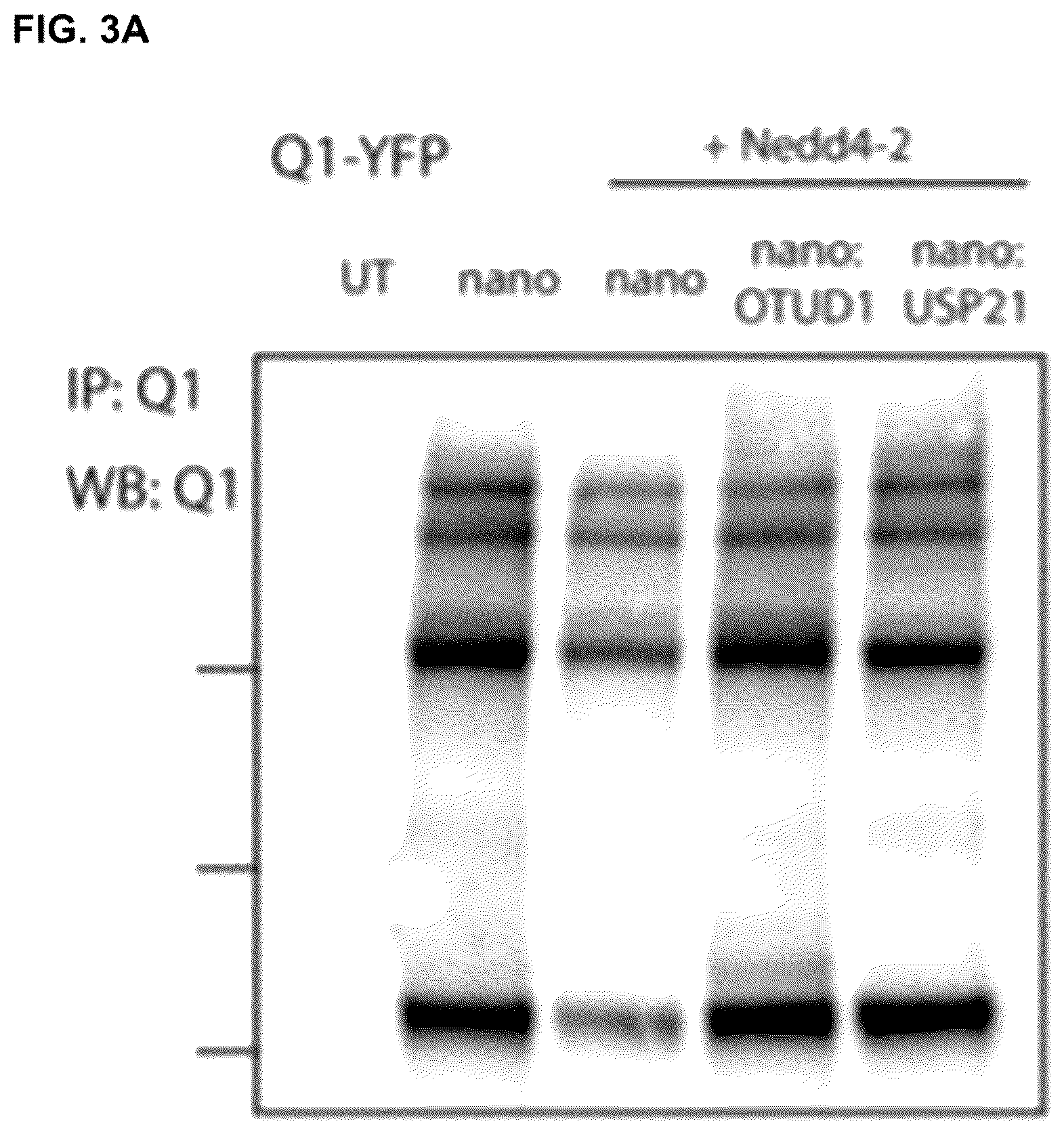 Patent US12351845 Figure 3 – Compositions and methods for using engineered deubiquitinases for probing ubiquitin-dependent cellular processes
