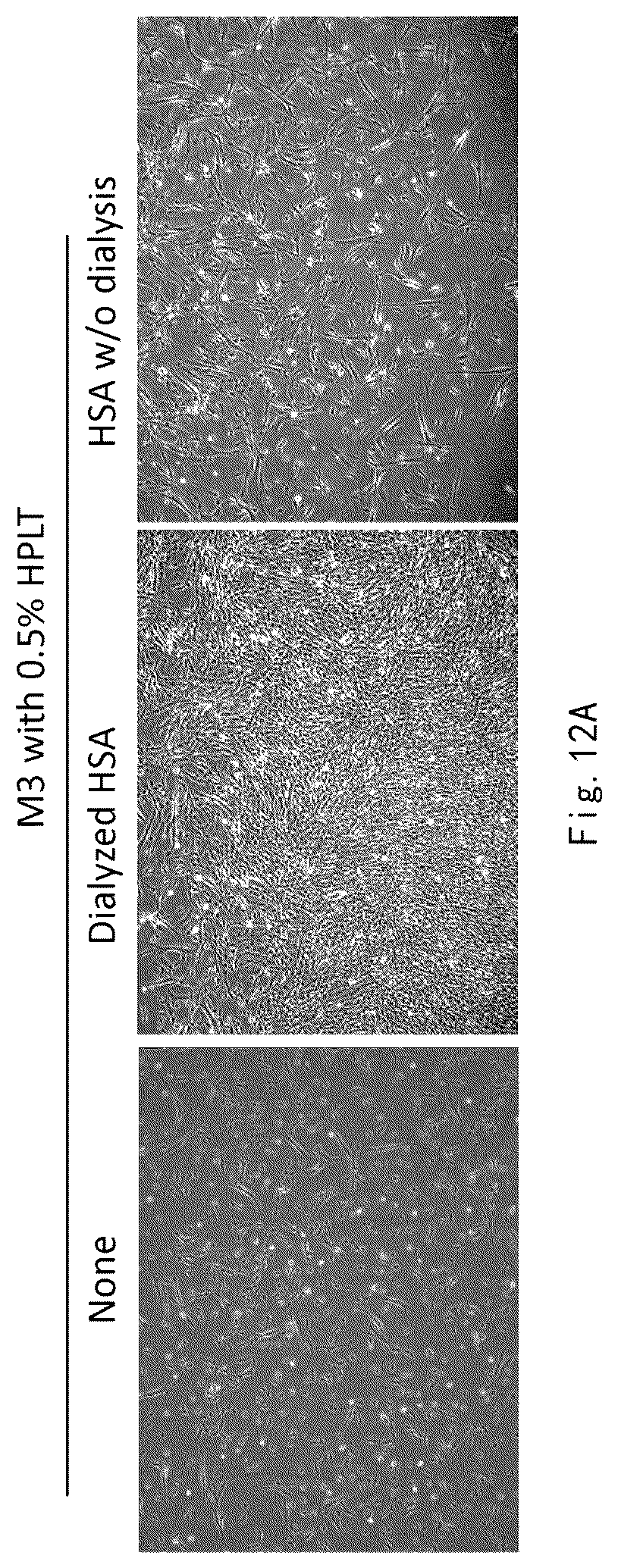 Patent US12359173 Figure 14 – Serum-free and xeno-free culture medium for expanding mesenchymal stem cells