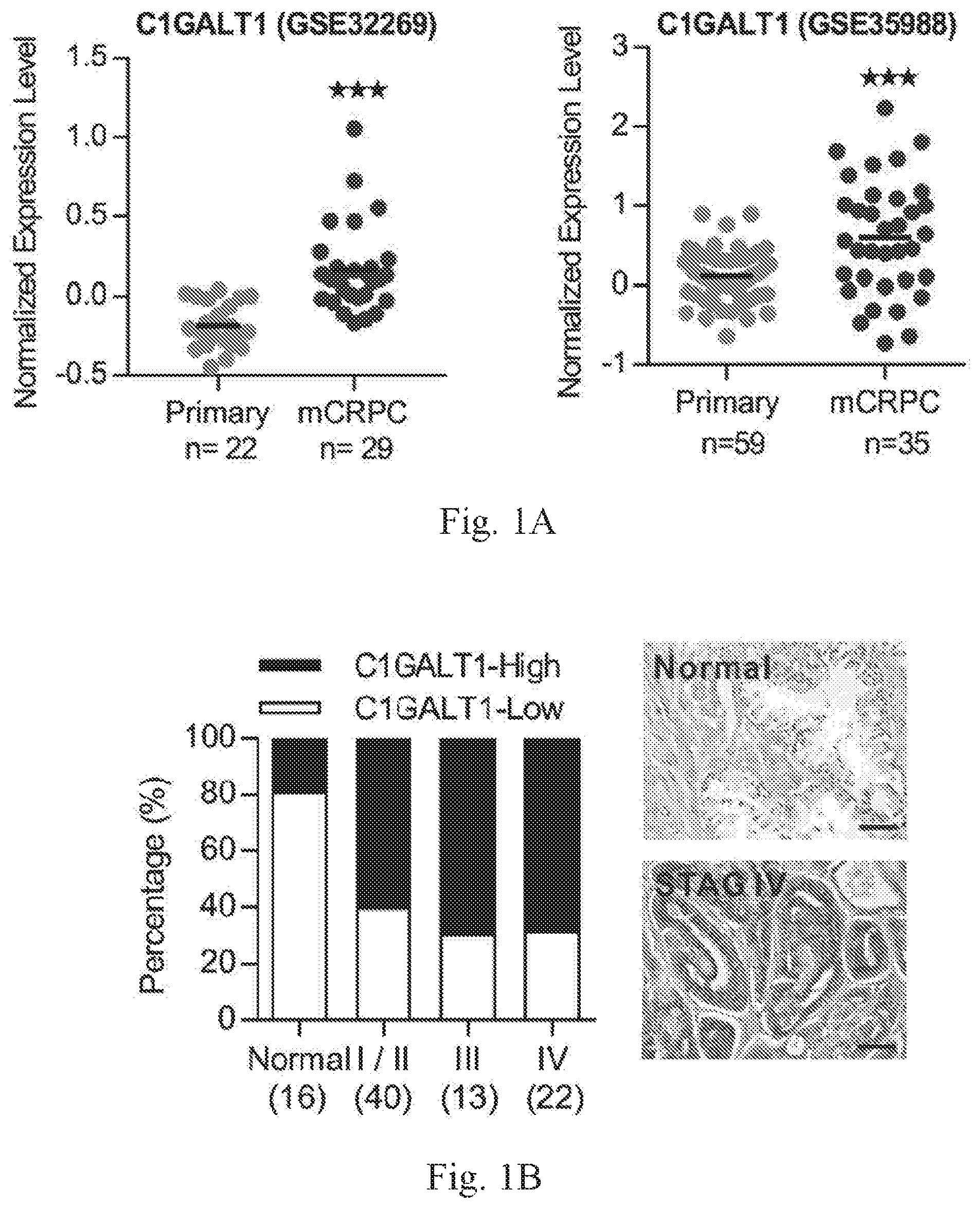 Patent US12359259 — Biomarkers for predicting prostate cancer progression — Figure 1