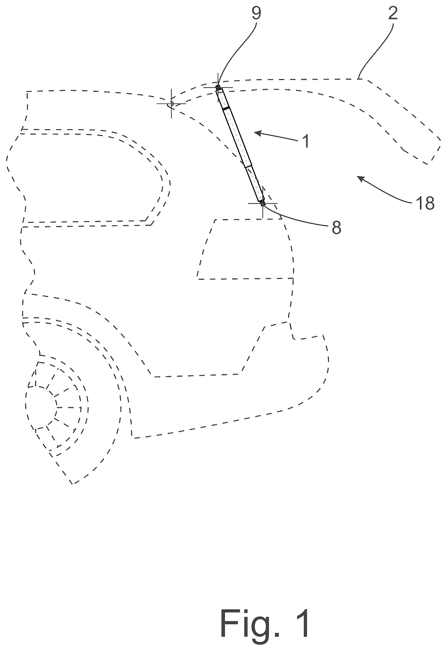 Patent US12359483 — Drive device for a closure element of a motor vehicle — Figure 1