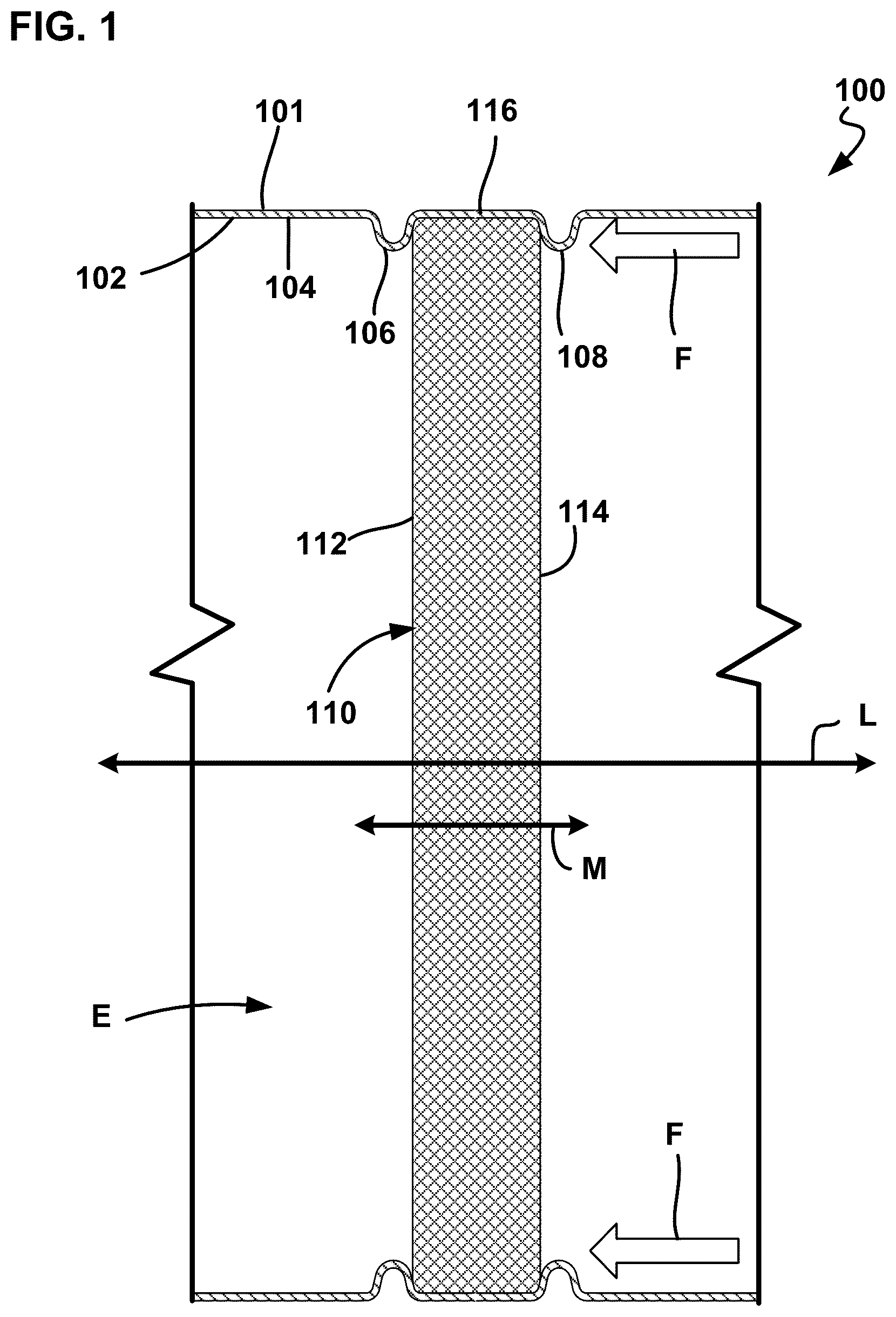 Patent US12359596 — Retention apparatus for wire mesh arrangement — Figure 1