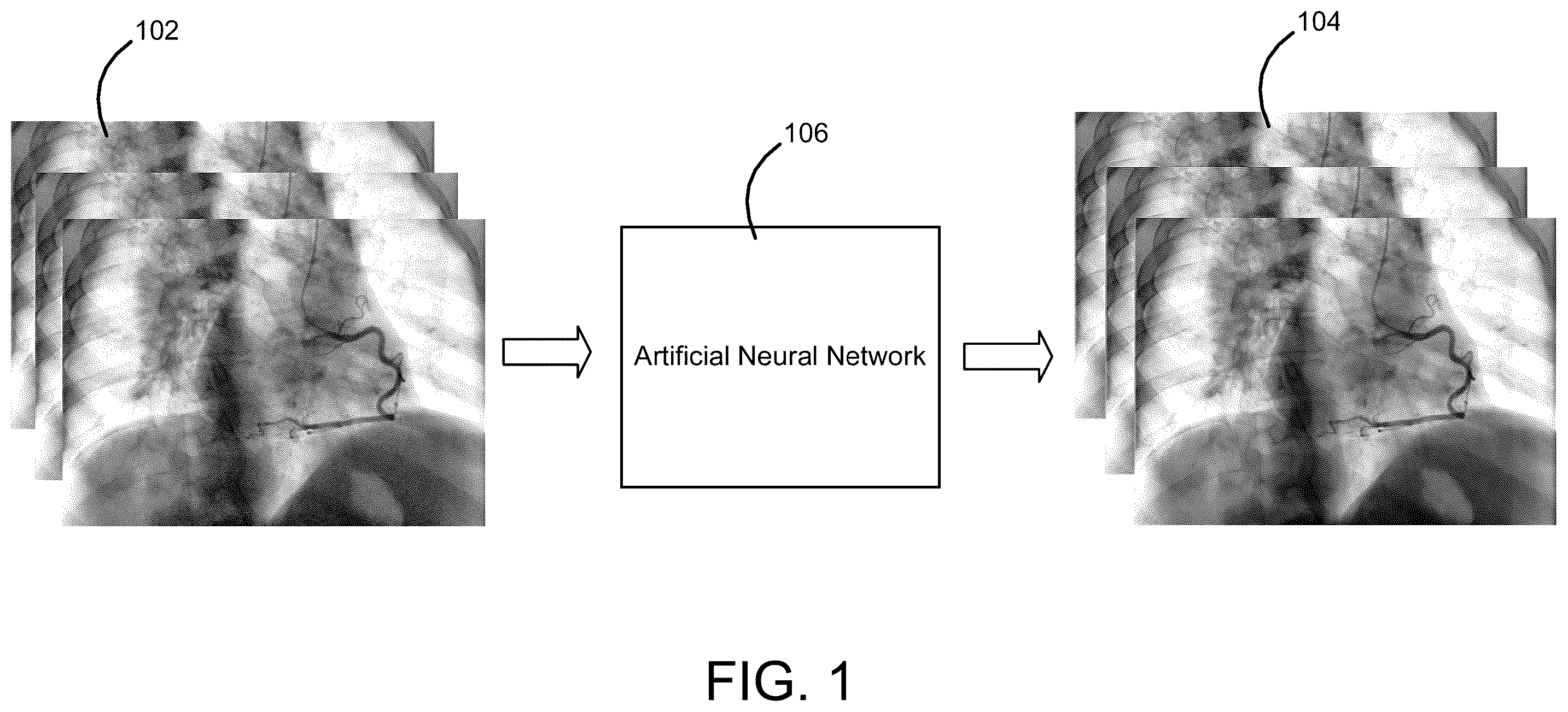 Patent US12361520 — Systems and methods for deblurring and denoising medical images — Figure 1