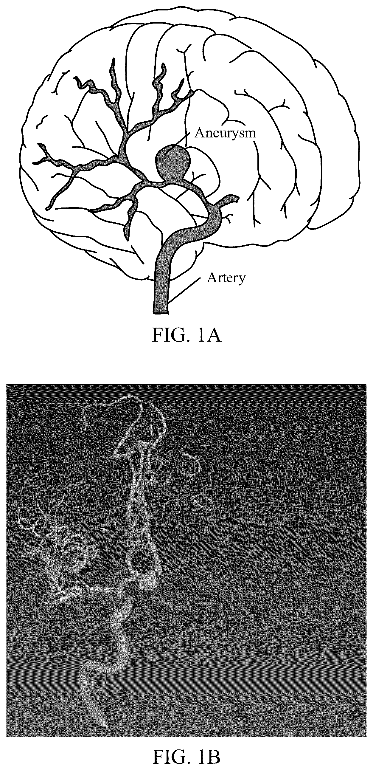 Patent US12361547 — Data processing method and apparatus, device and medium — Figure 1