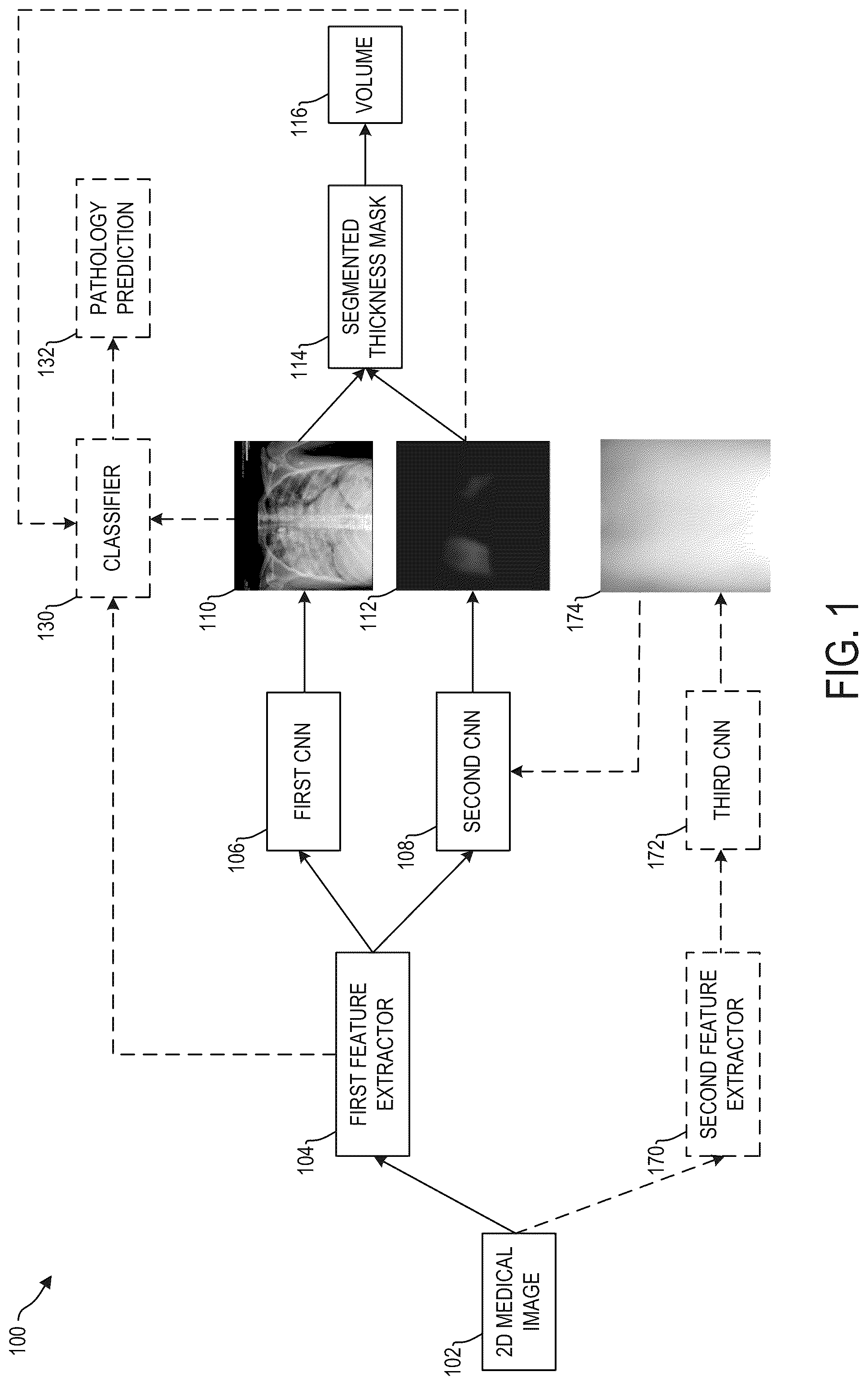 Patent US12361553 — System and methods for inferring thickness of object classes of interest in two-dimensional medical images using deep neural networks — Figure 1