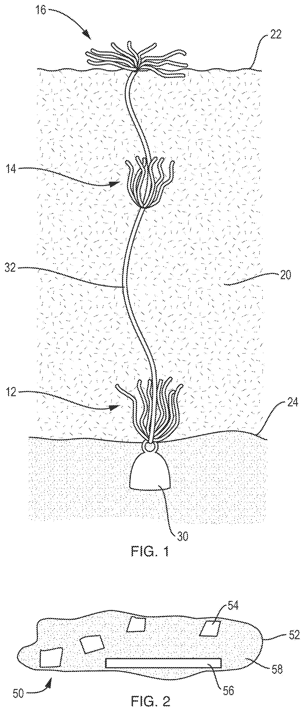 Patent US12365602 — Removal and detection of algae, their toxins, and excess nutrients, other contaminants, and toxic substances — Figure 1