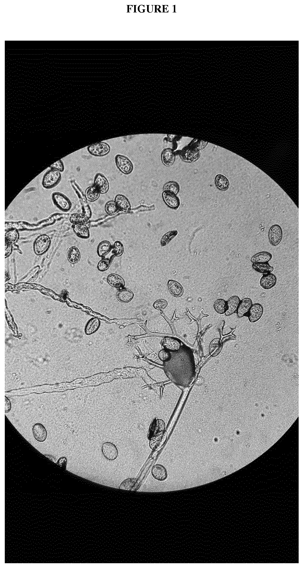 Patent US12365913 — Downy mildew resistant spinach plant — Figure 1