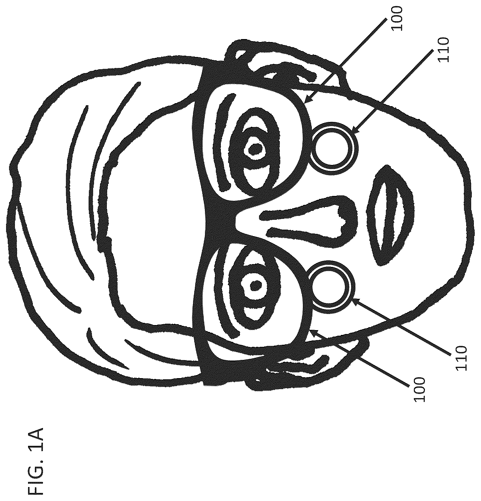 Patent US12366768 Figure 1 – Head mounted display assembly with control of head mounted display and loupe position and orientation