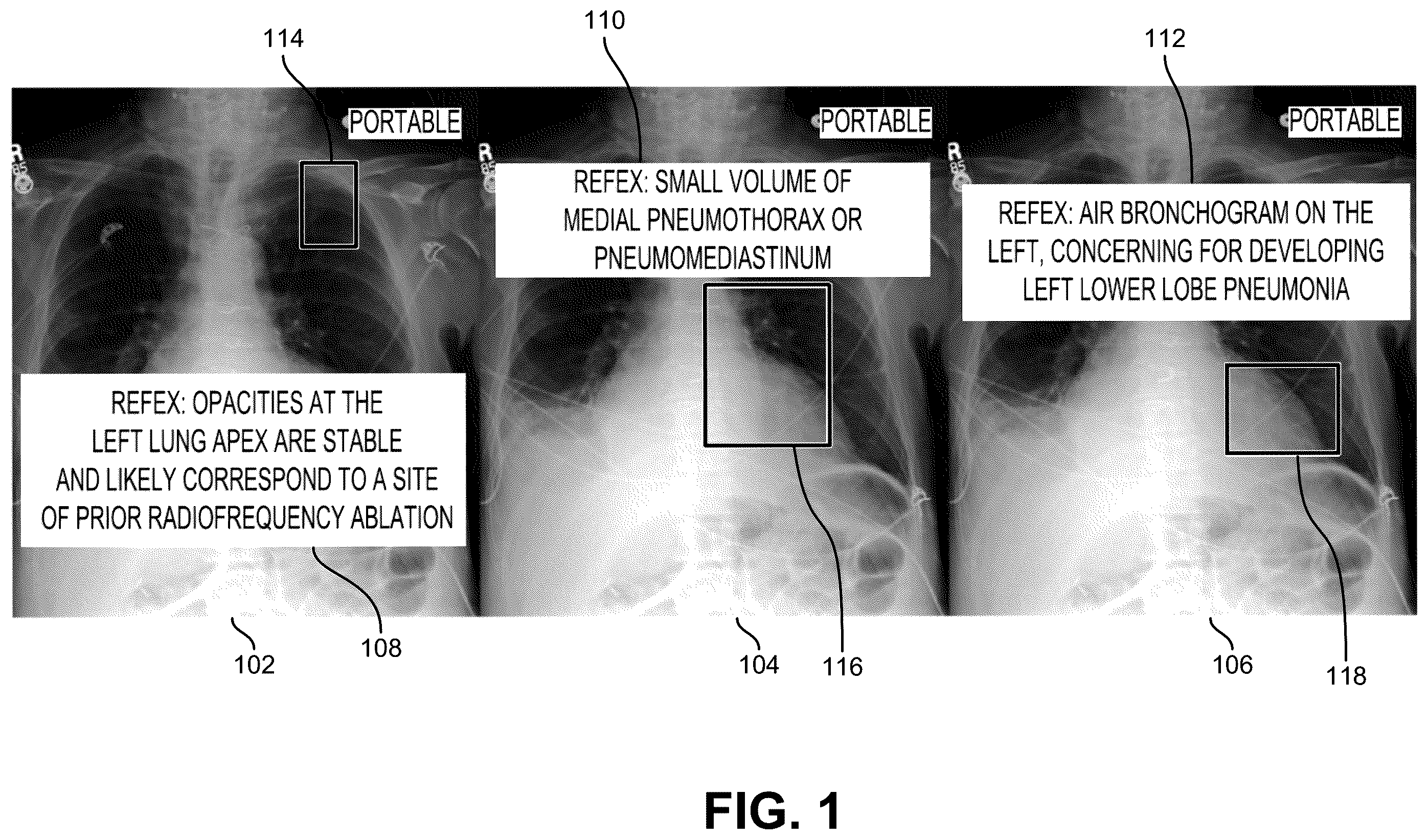 Patent US12367261 Figure 1 – Extending supervision using machine learning