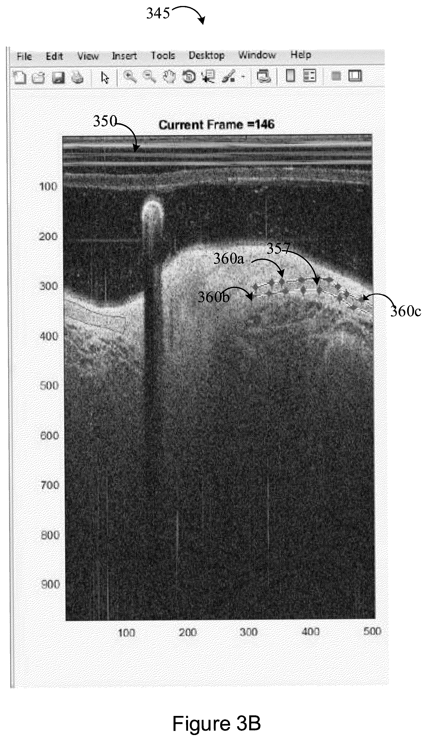 Patent US12367588 Figure 13 – Systems and methods for classification of arterial image regions and features thereof