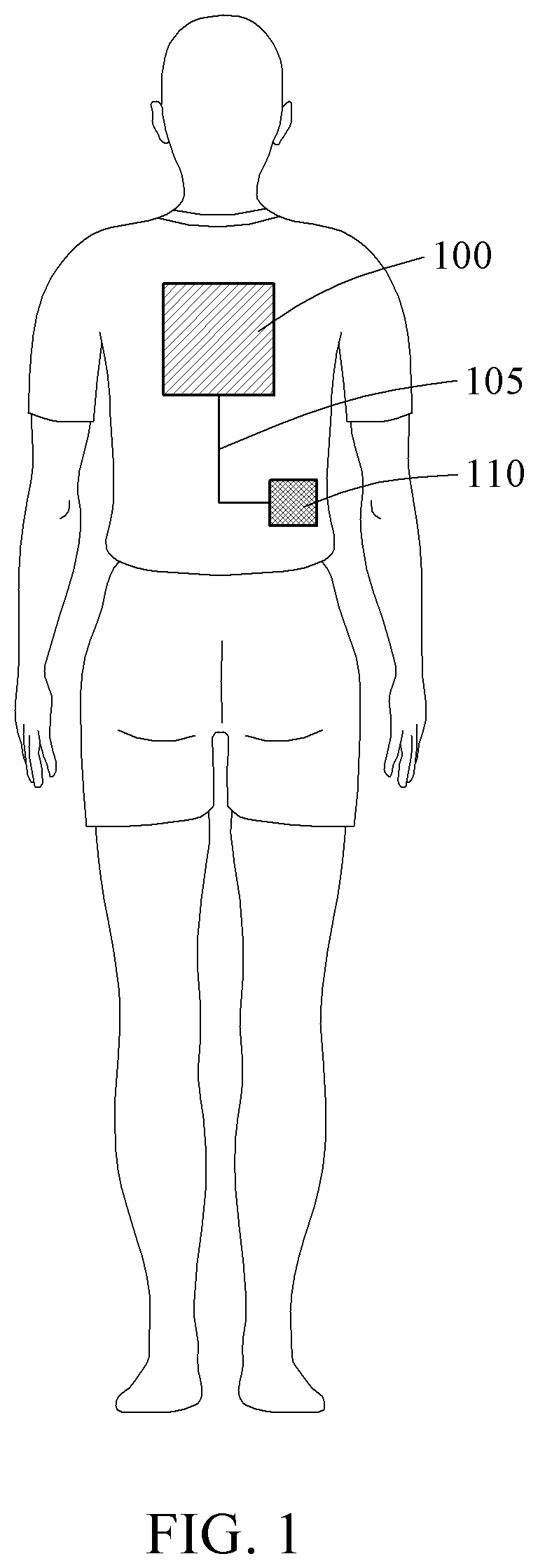 Patent US12368234 — Fibre-based wearable patch antenna — Figure 1