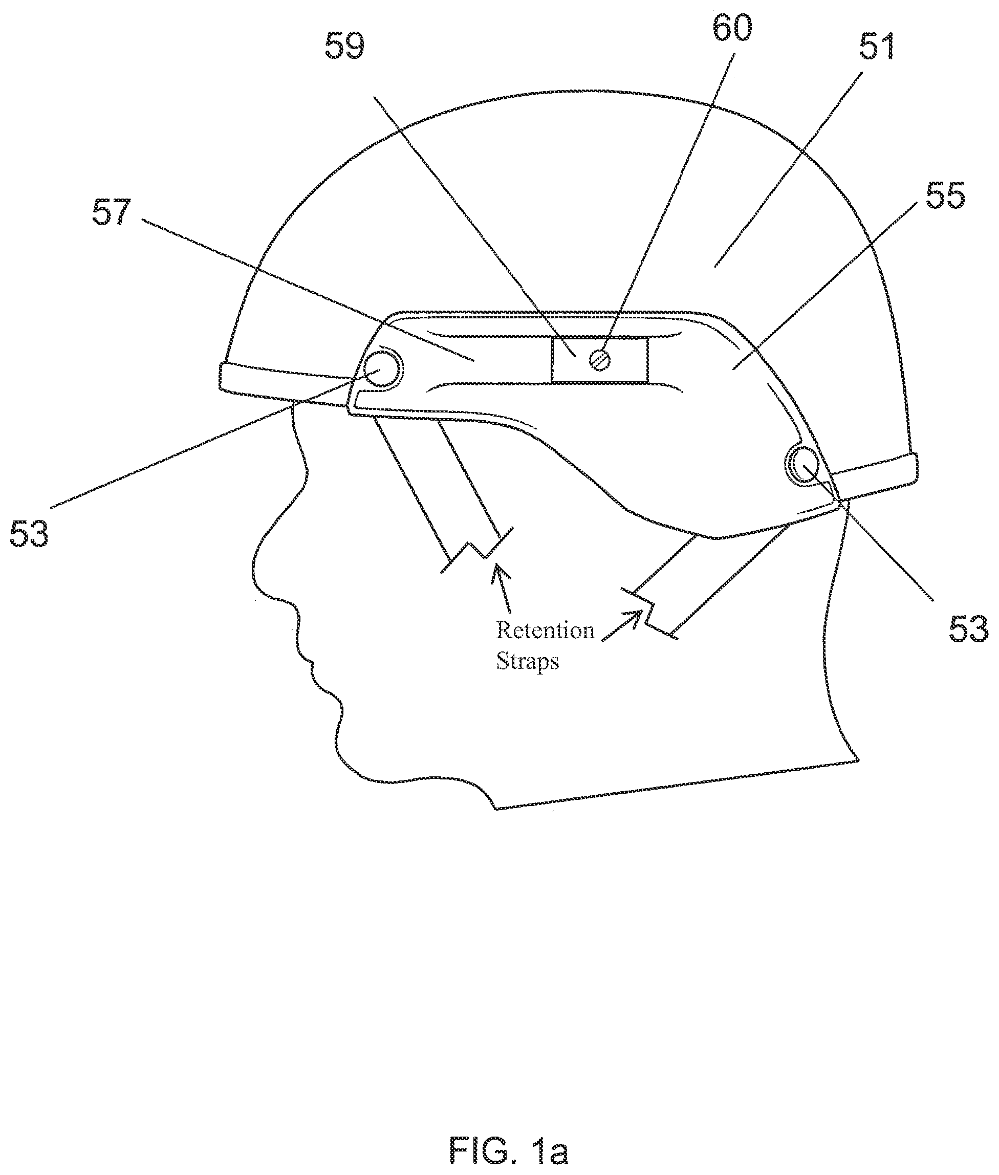 Patent US12376639 — Hinged attachment of headgear to a helmet — Figure 1