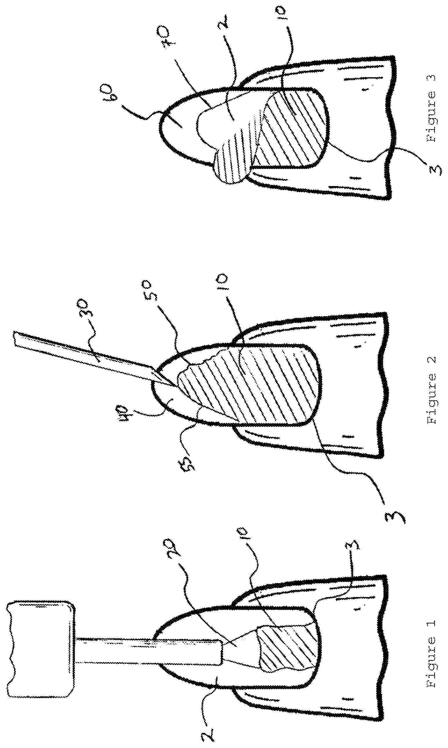 Patent US12376662 — Method for nail manicuring — Figure 1