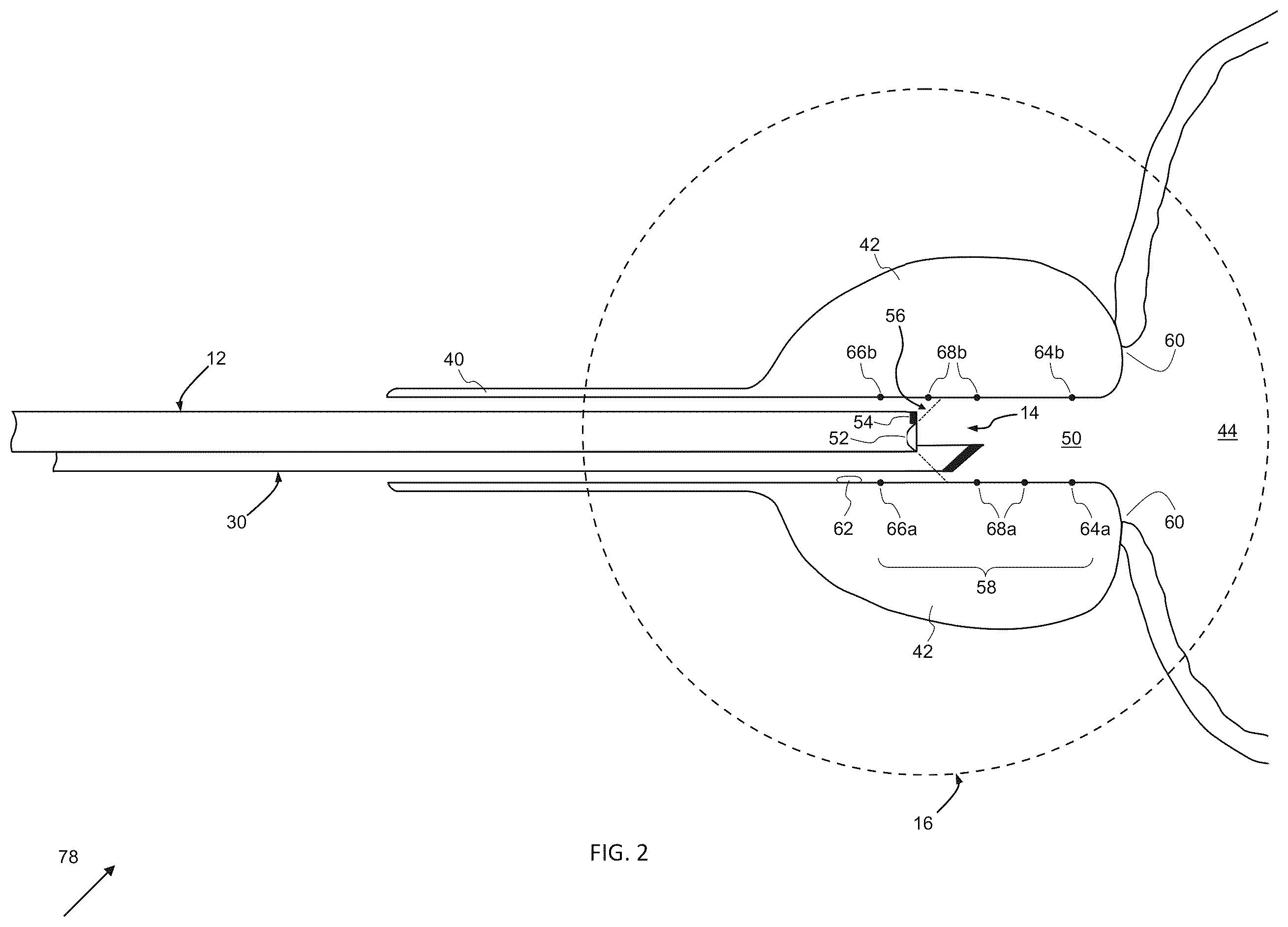 Patent US12376733 Figure 2 – Systems, apparatuses, and methods for endoscopy