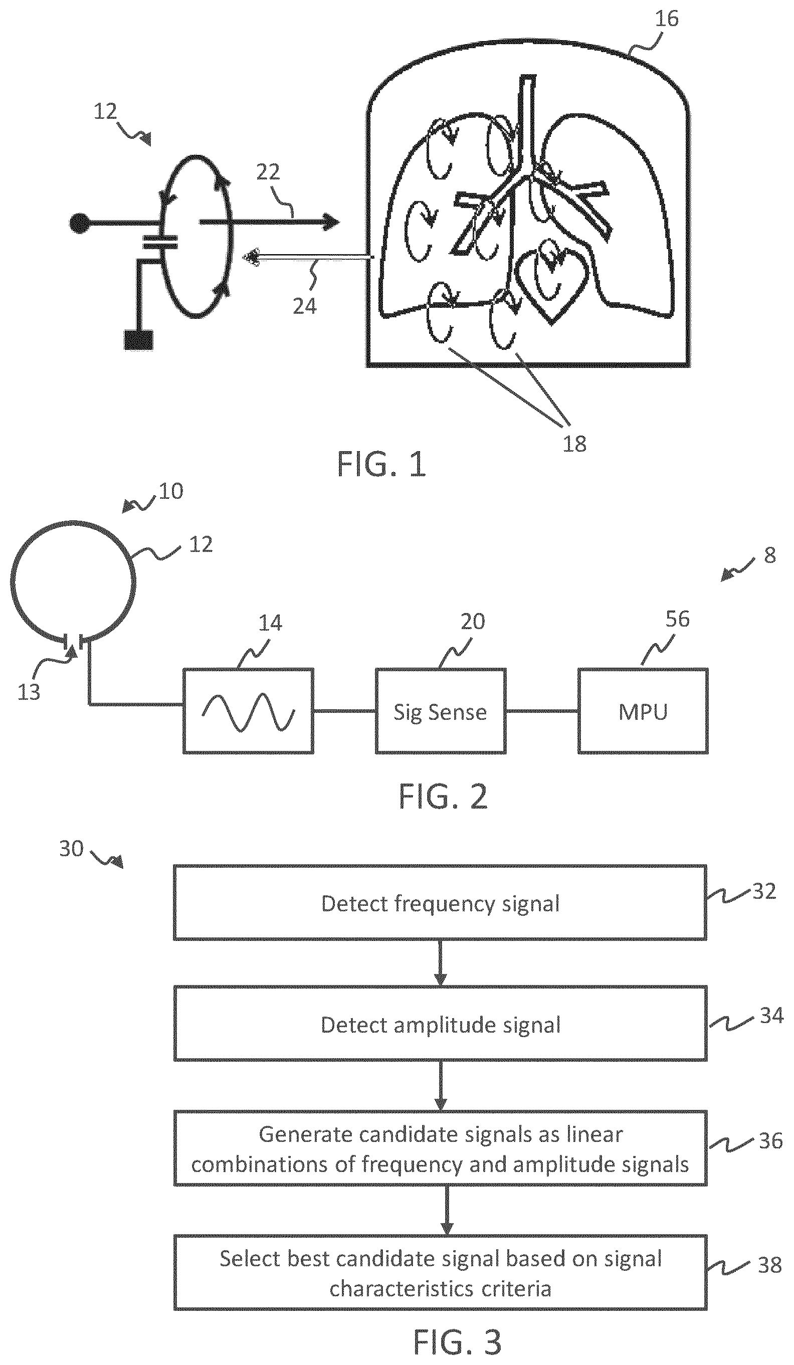 Patent US12376755 — Inductive sensing system and method — Figure 1