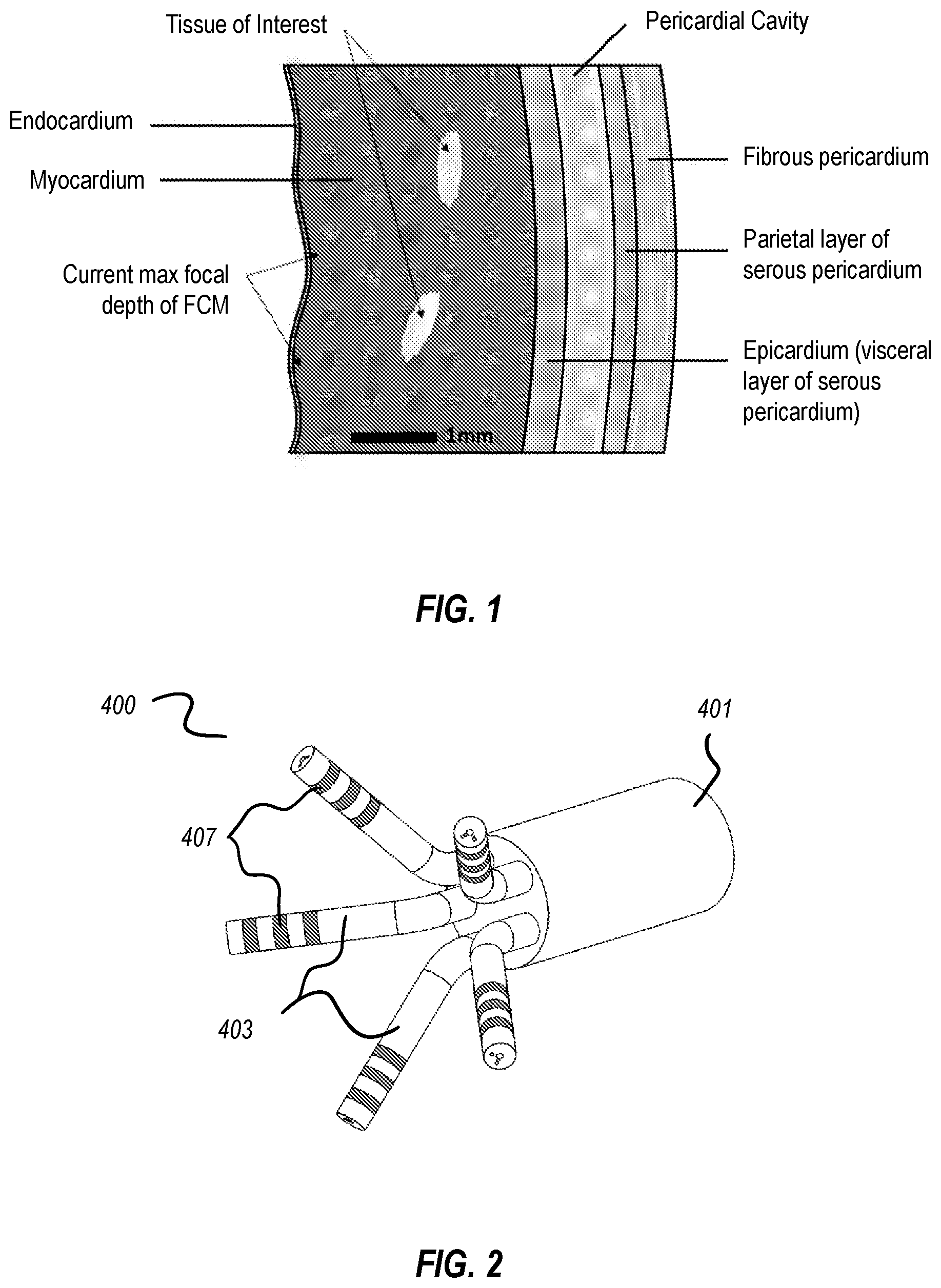 Patent US12376762 — Cardiac tissue characterization using catheterized light scattering spectroscopy — Figure 1