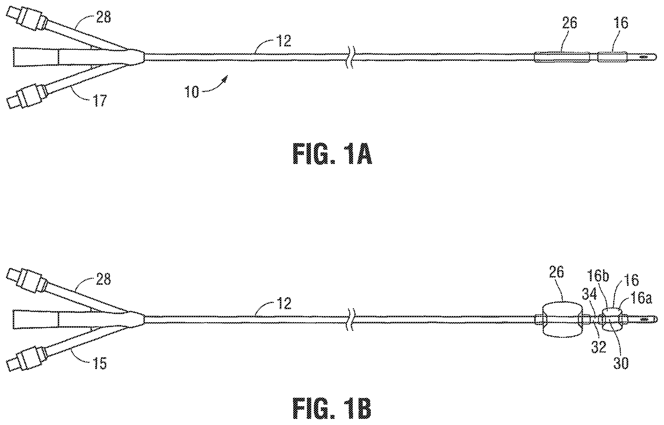 Patent US12376785 Figure 1 – Catheter for monitoring intra-abdominal pressure for assessing preeclampsia