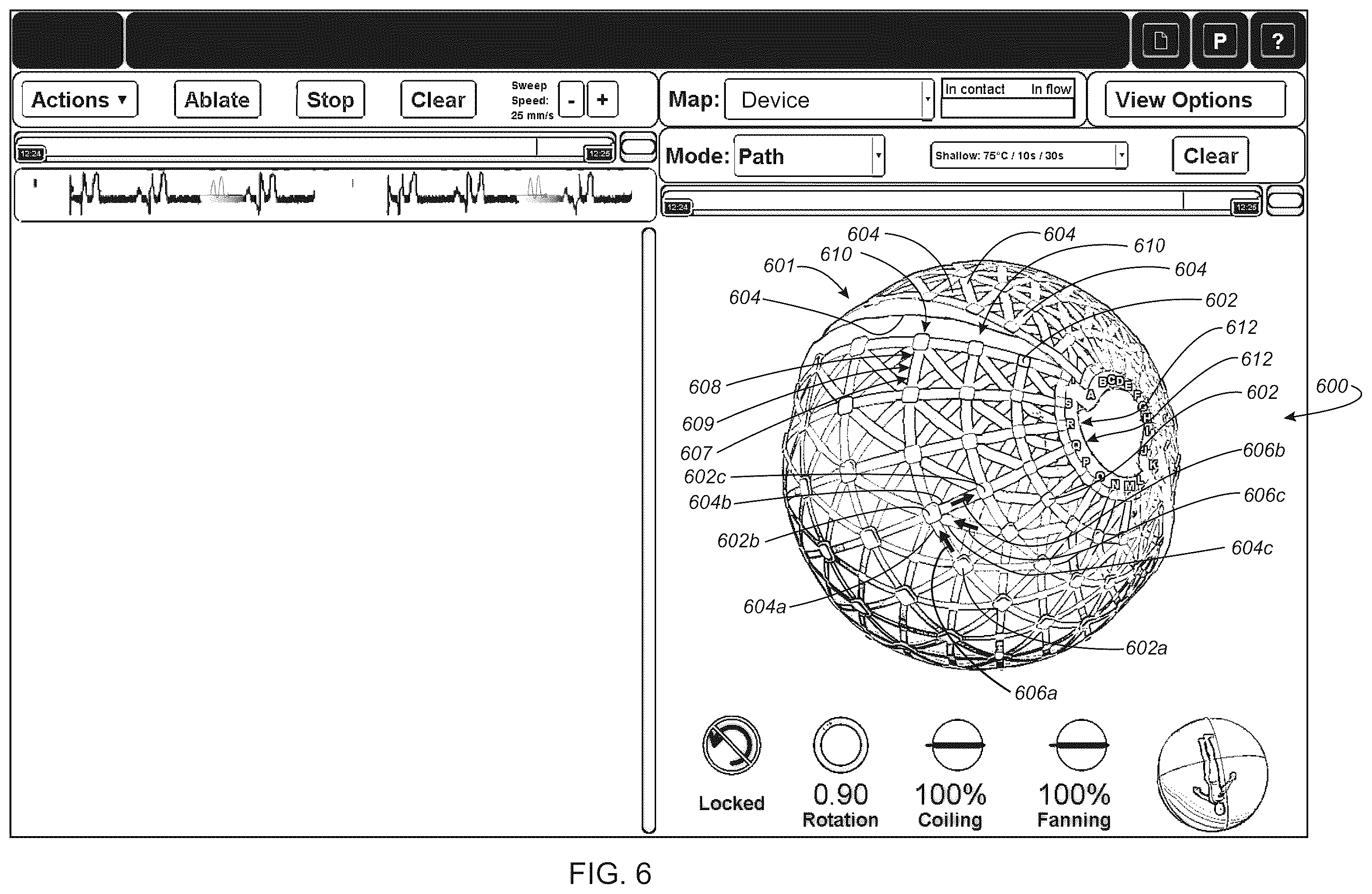 Patent US12376796 Figure 17 – Systems and methods for activating transducers
