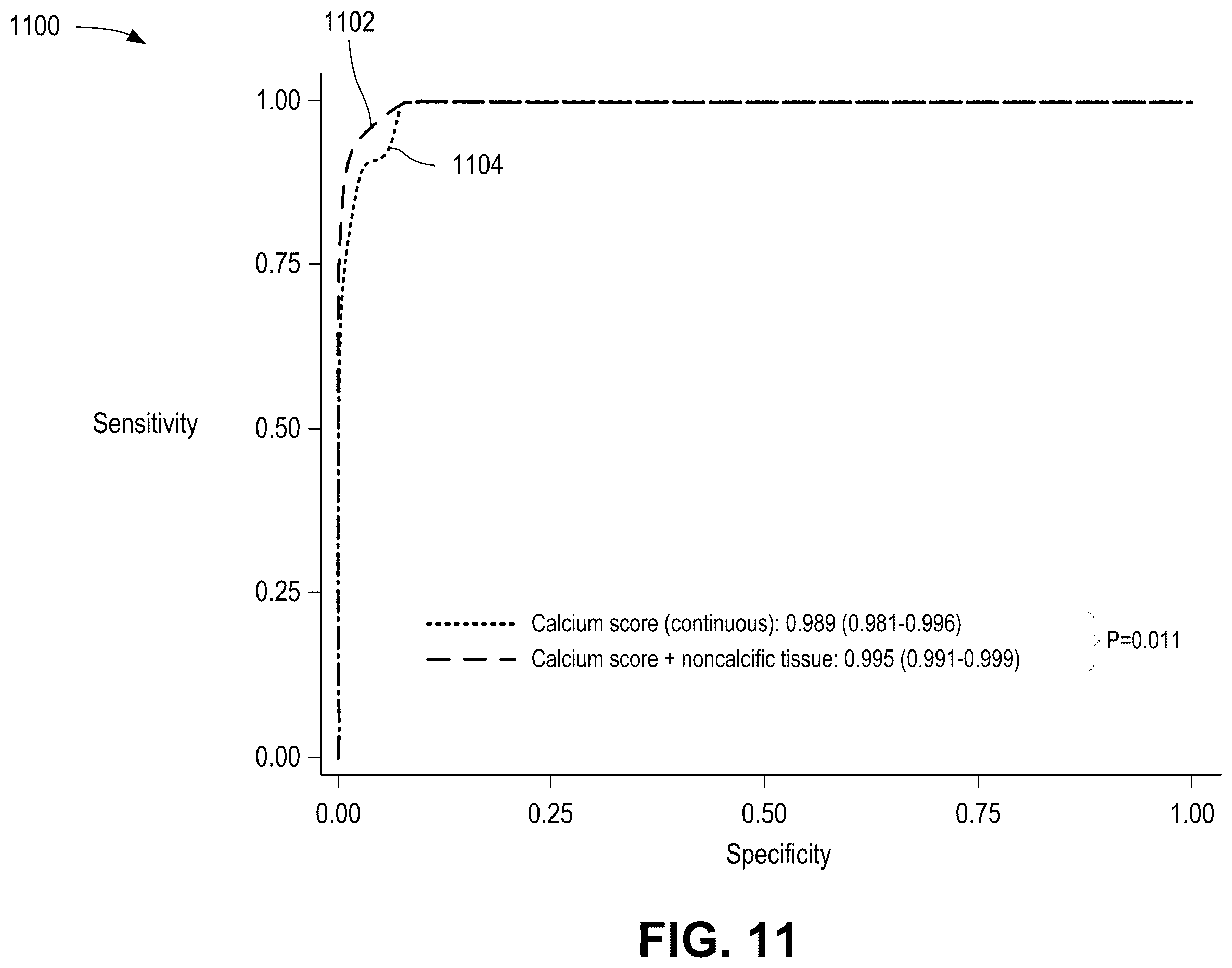 Patent US12376814 Figure 11 – Quantification of noncalcific and calcific valve tissue from coronary CT angiography
