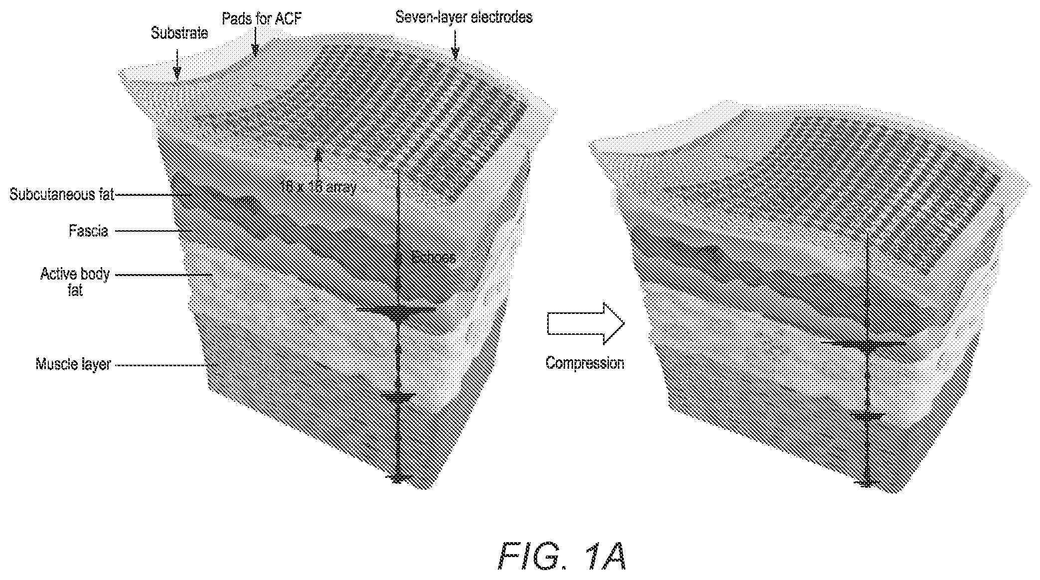 Patent US12376822 — Three-dimensional mapping of deep tissue modulus by stretchable ultrasonic arrays — Figure 1