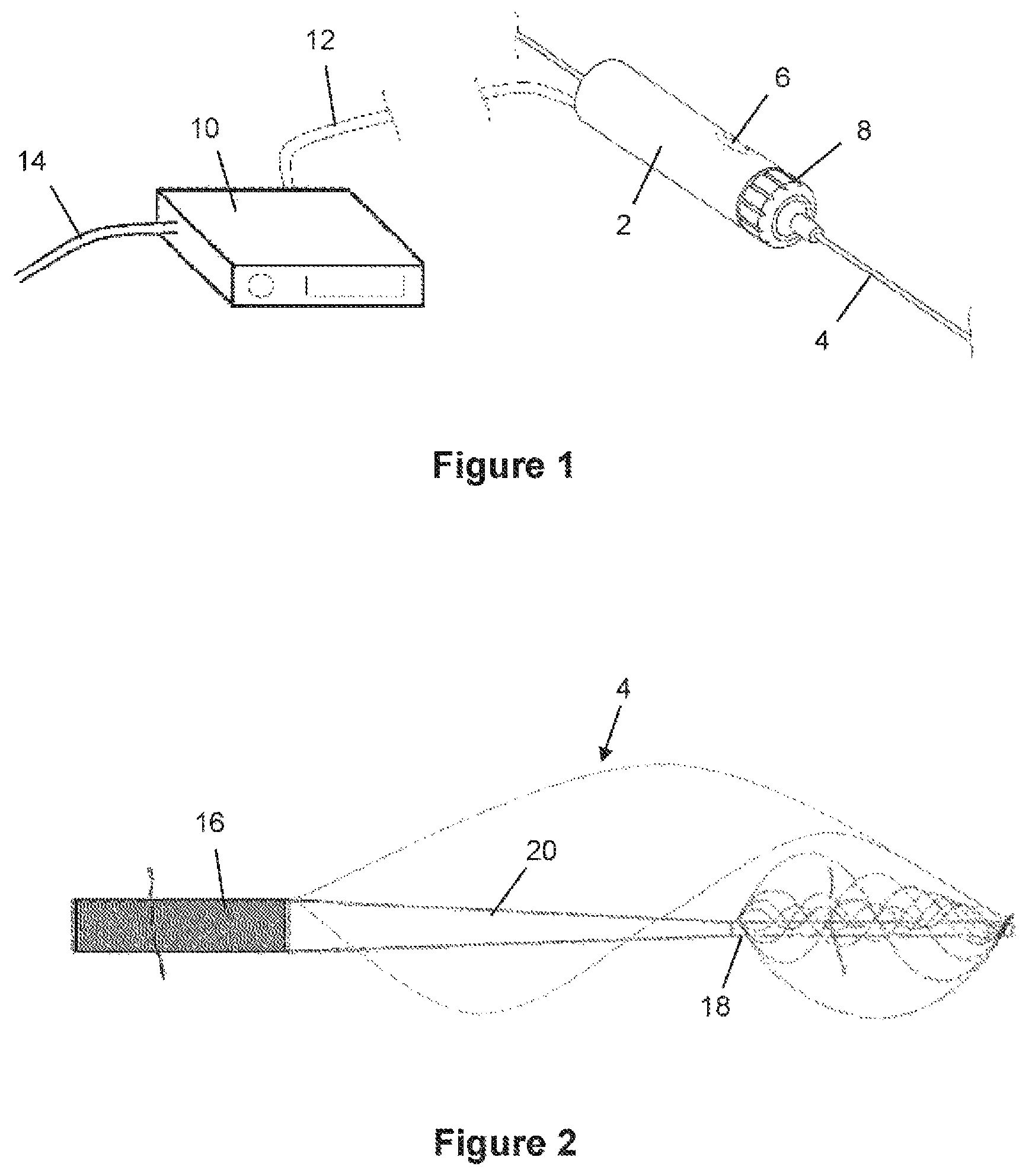 Patent US12376826 — Determining the condition of vessels in the body — Figure 1
