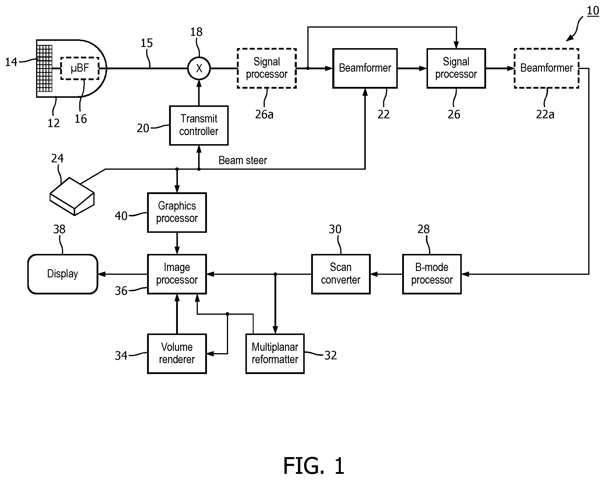 Patent US12376833 — Methods and systems for random noise supression and filtering of acoustic clutter via autoregressive moving average filter — Figure 1
