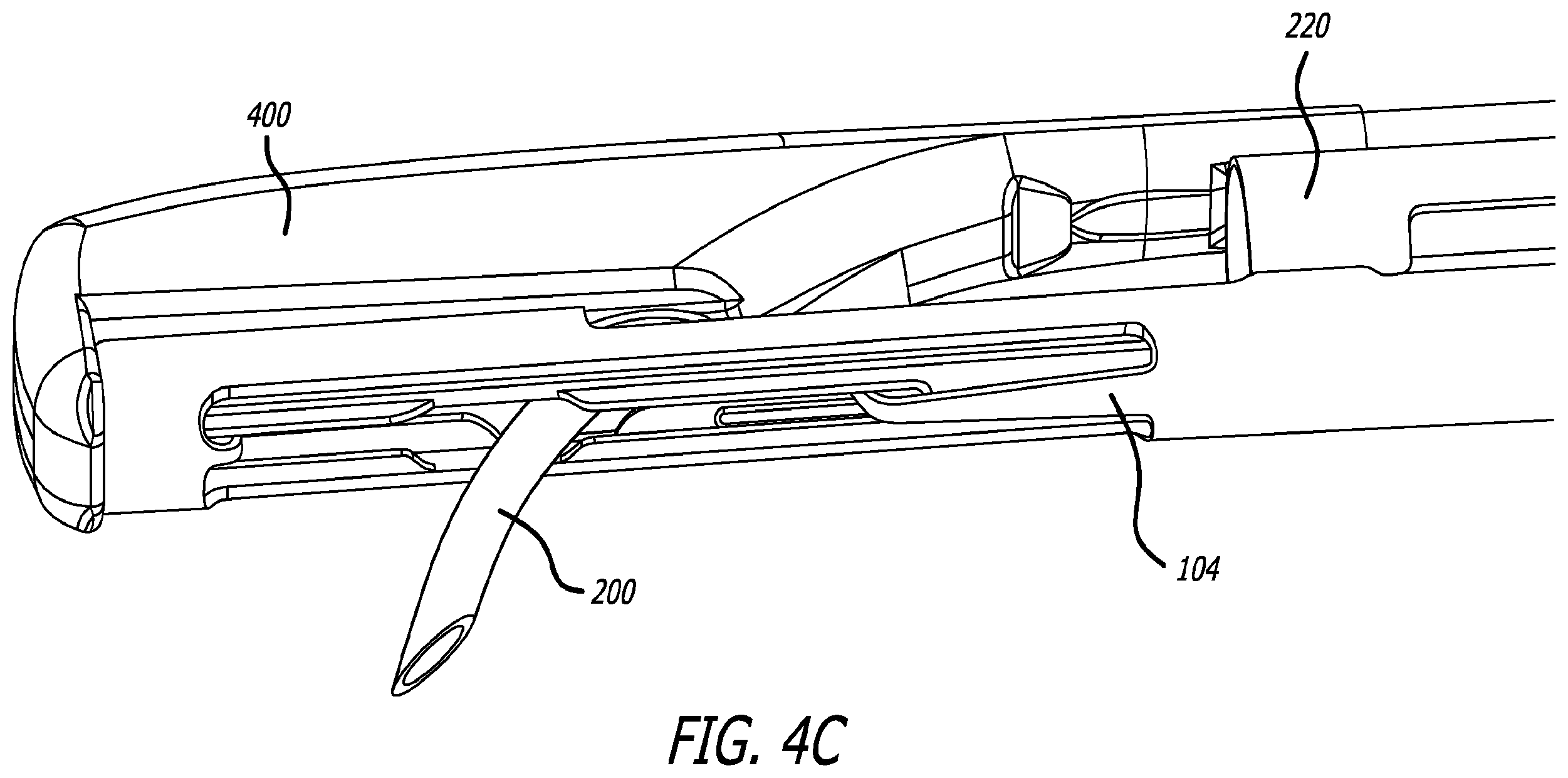 Patent US12376842 Figure 5 – Flexible system for delivering an anchor