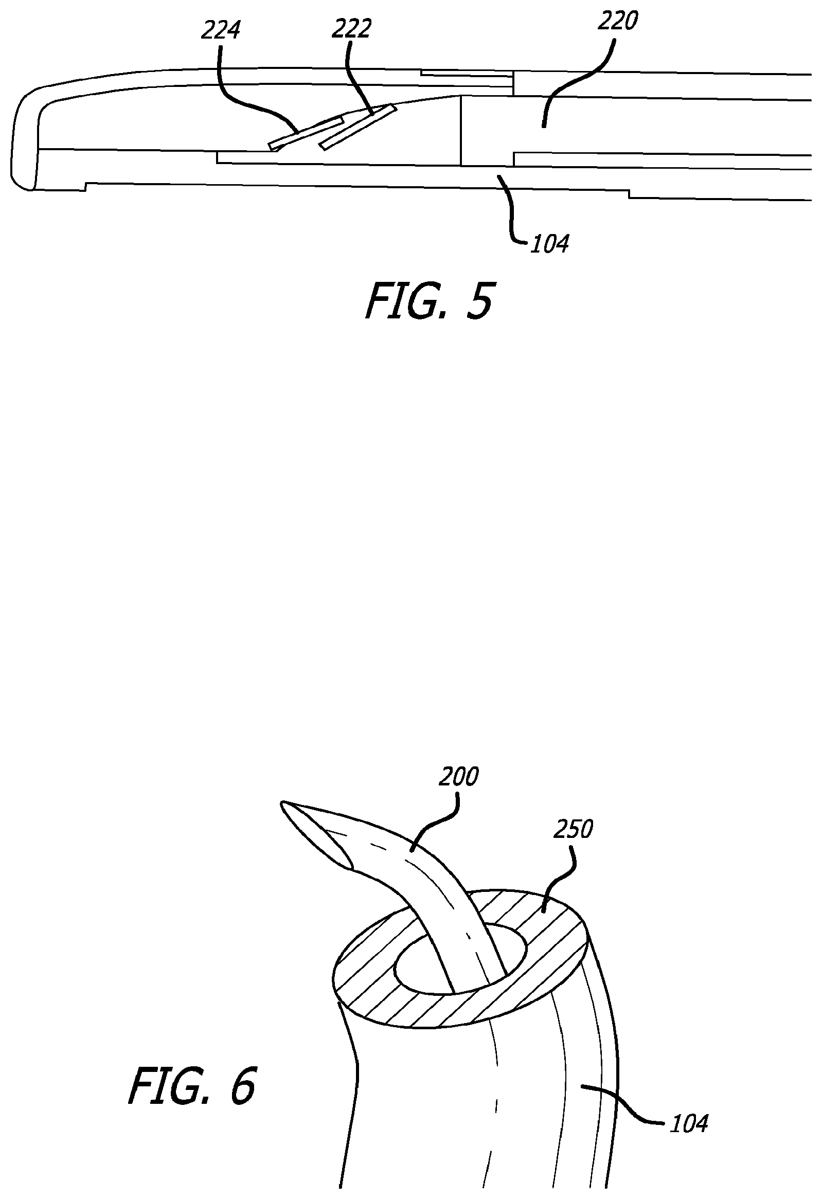 Patent US12376842 Figure 6 – Flexible system for delivering an anchor