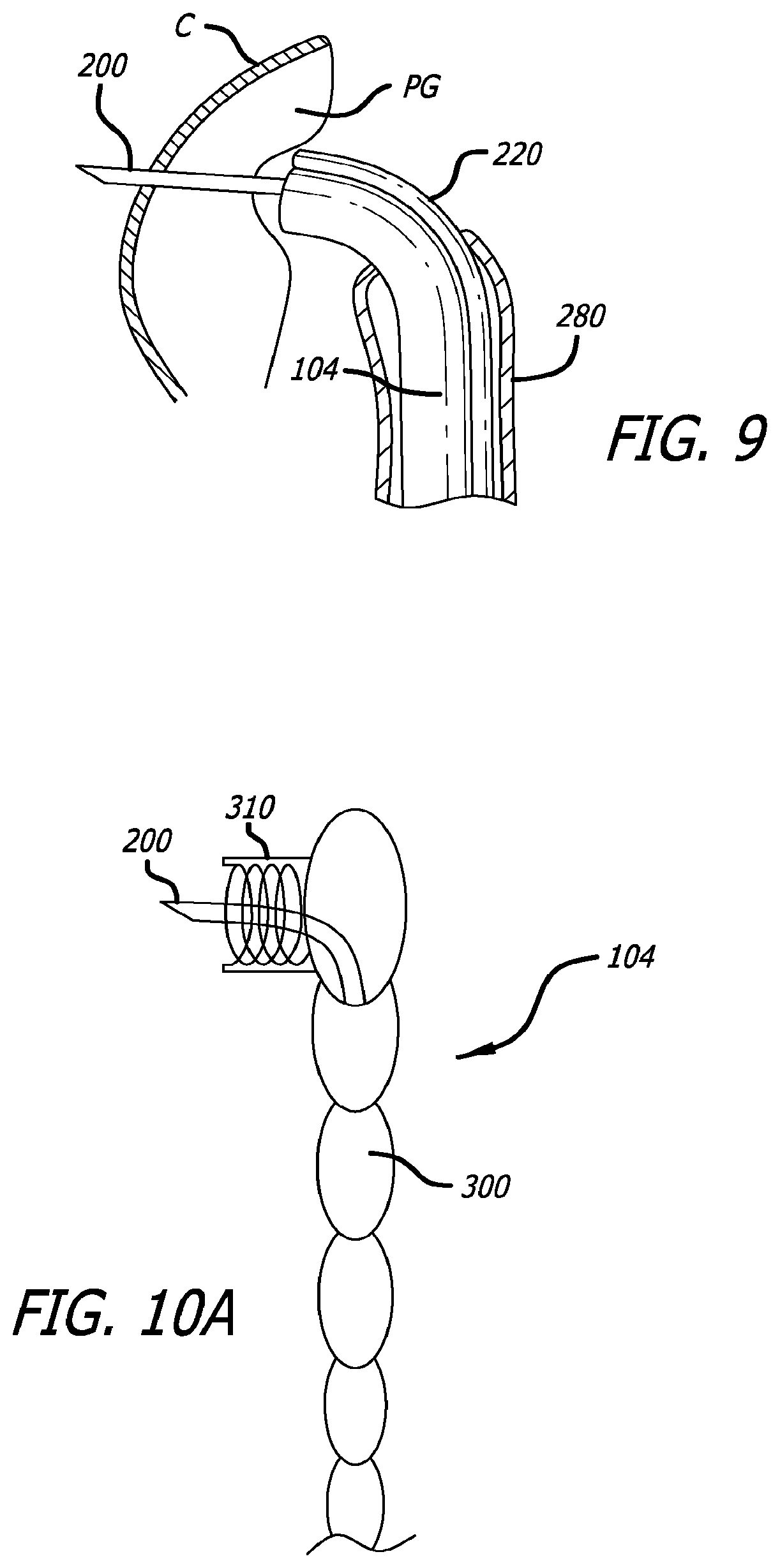 Patent US12376842 Figure 8 – Flexible system for delivering an anchor