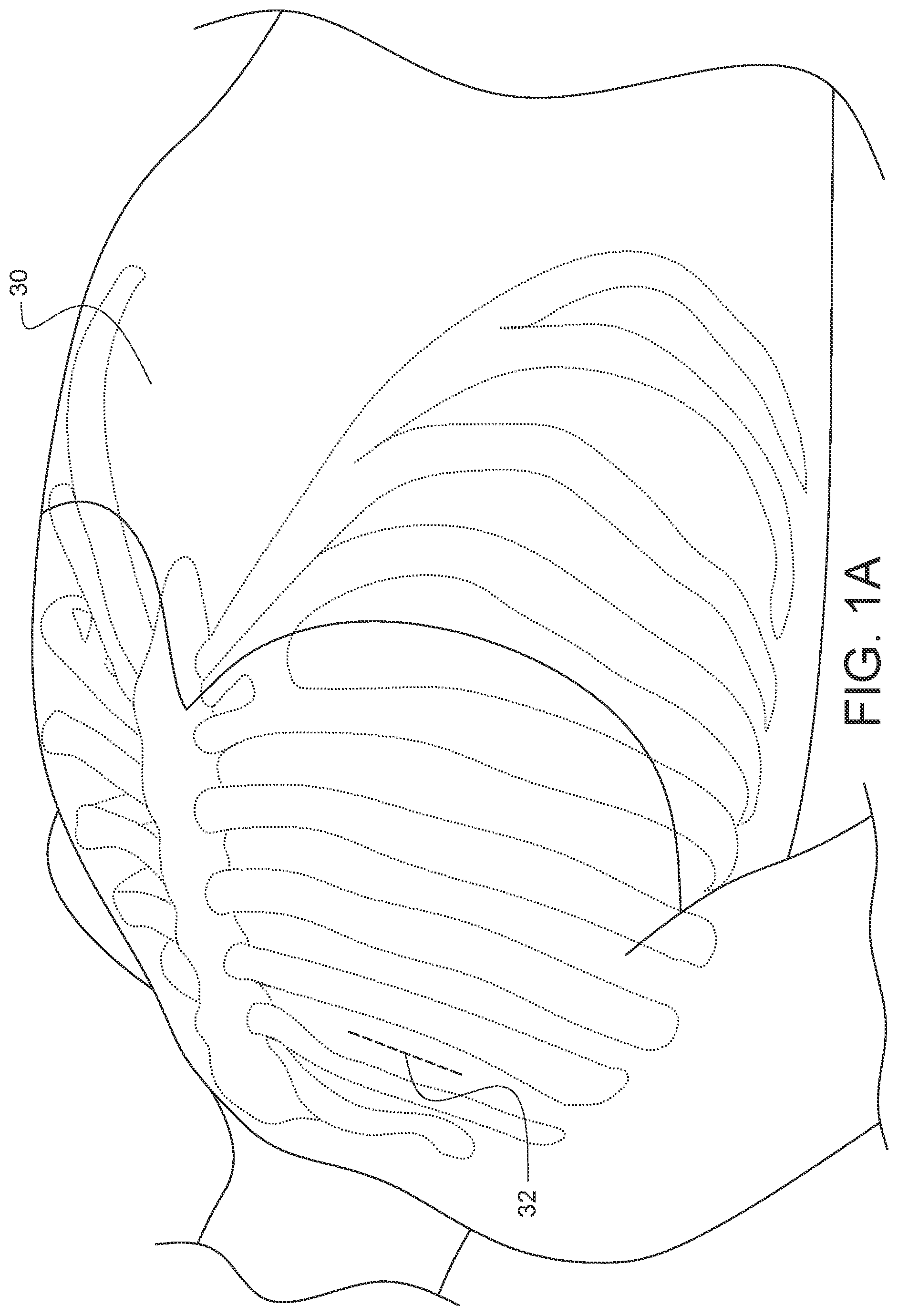 Patent US12376849 — Apparatus for suture management and methods thereof — Figure 1
