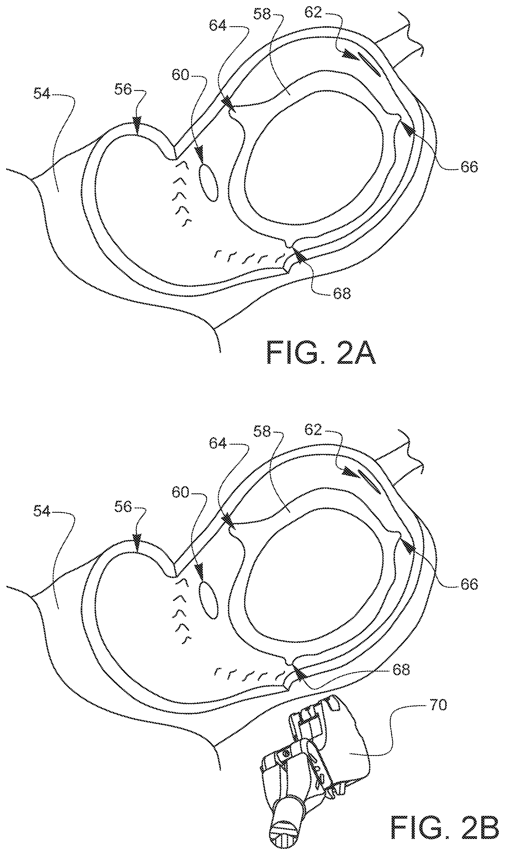 Patent US12376849 Figure 8 – Apparatus for suture management and methods thereof