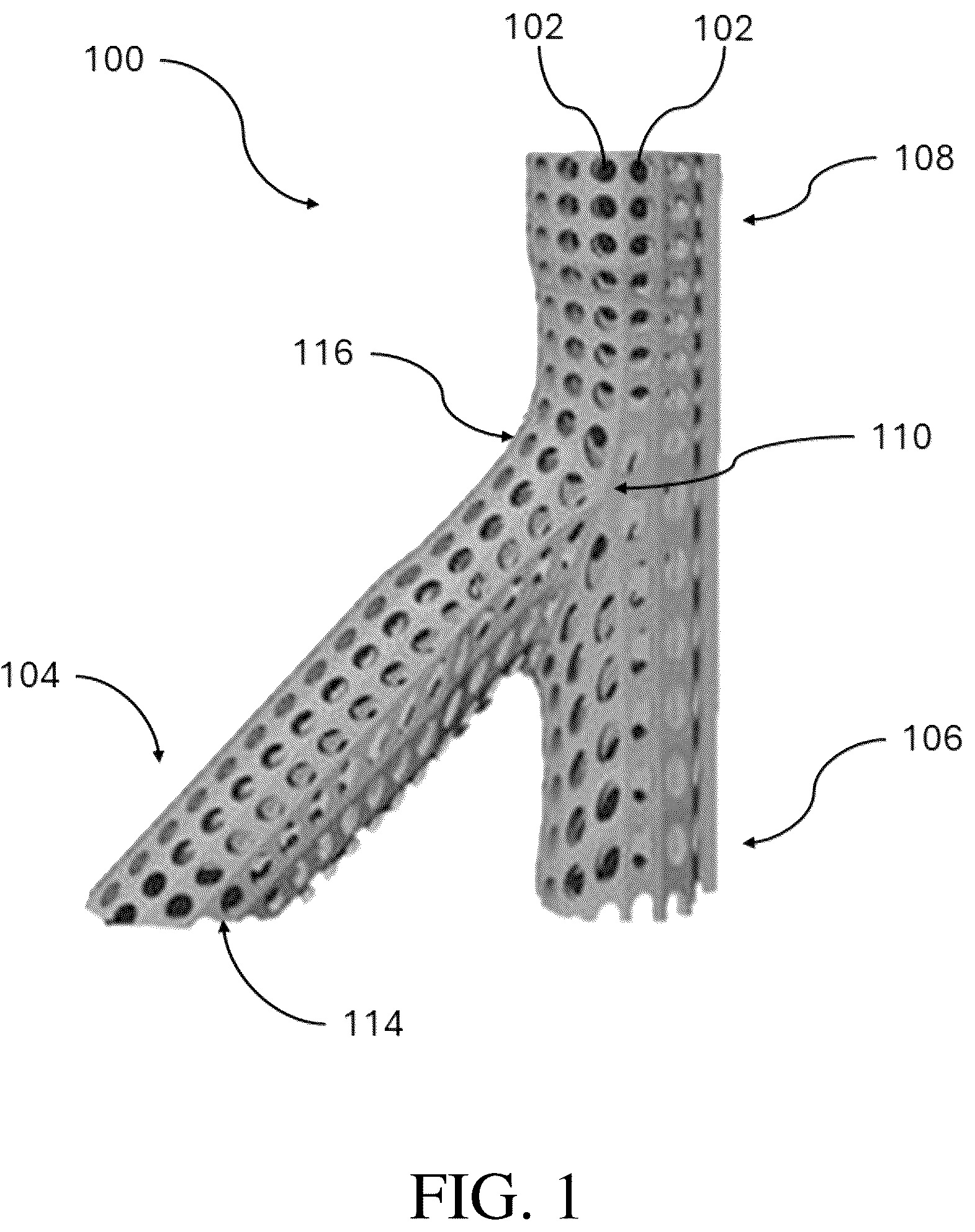 Patent US12376856 — Synthetic perivascular wrap — Figure 1