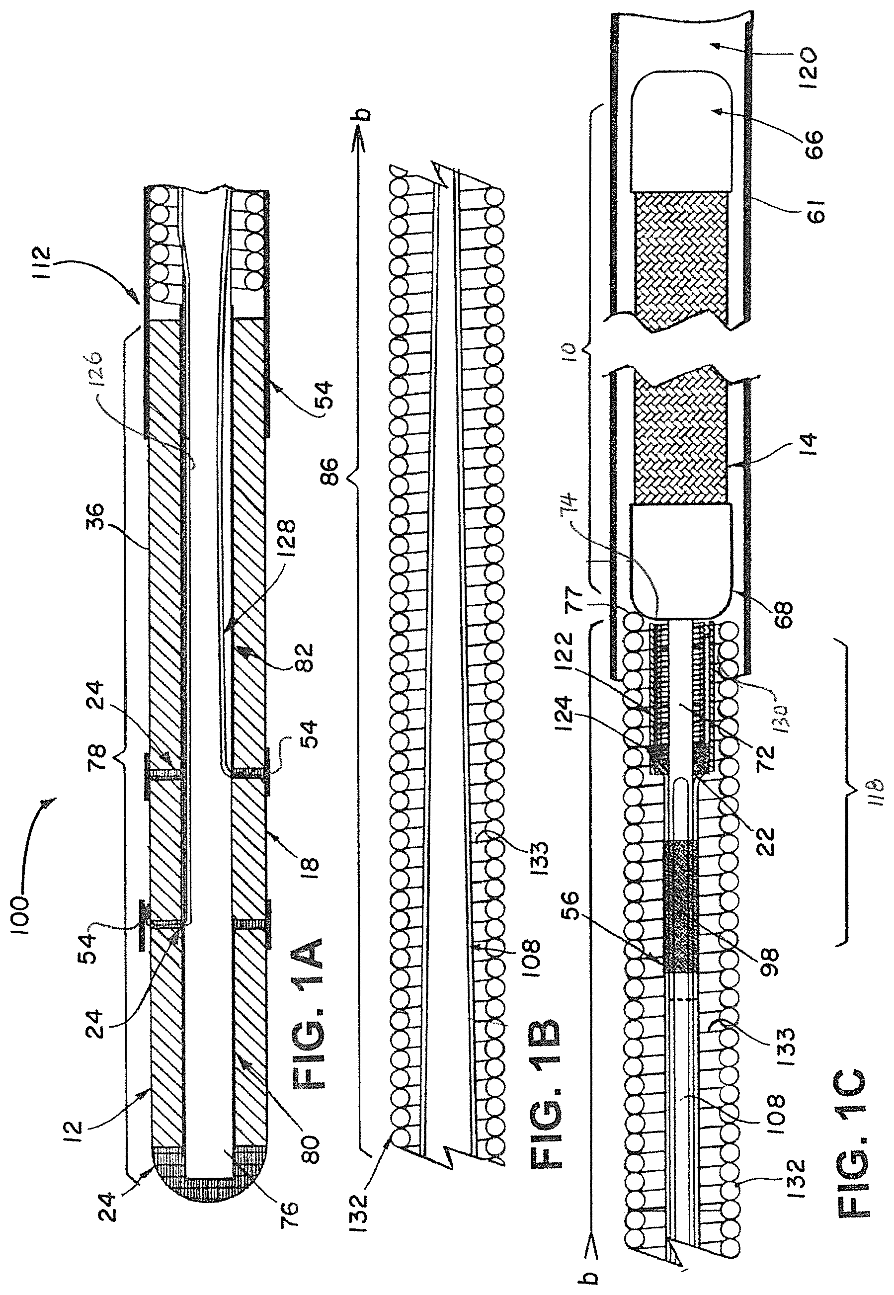 Patent US12376858 — Delivery and detachment systems and methods for vascular implants — Figure 1