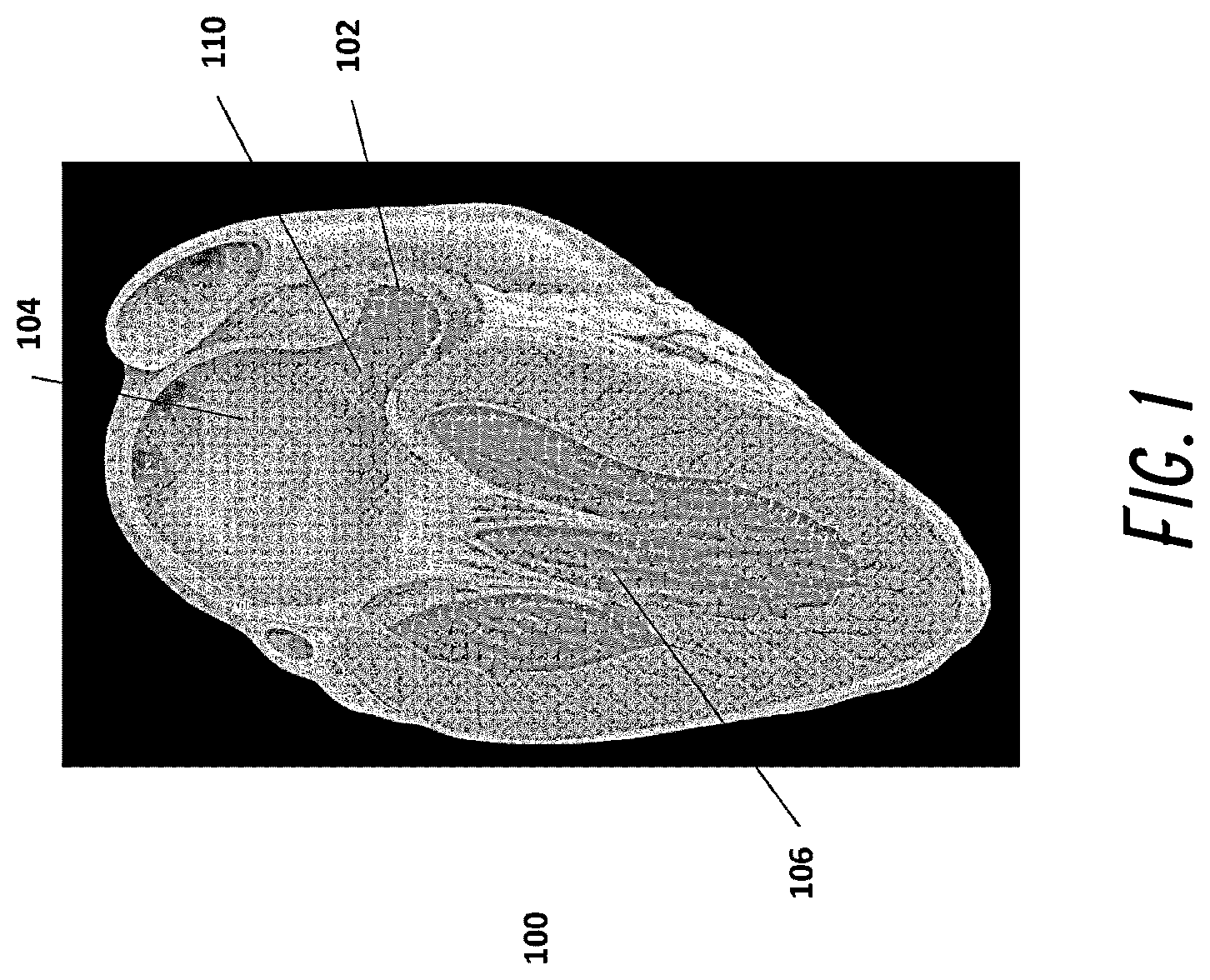 Patent US12376861 — Devices and methods for excluding the left atrial appendage — Figure 1