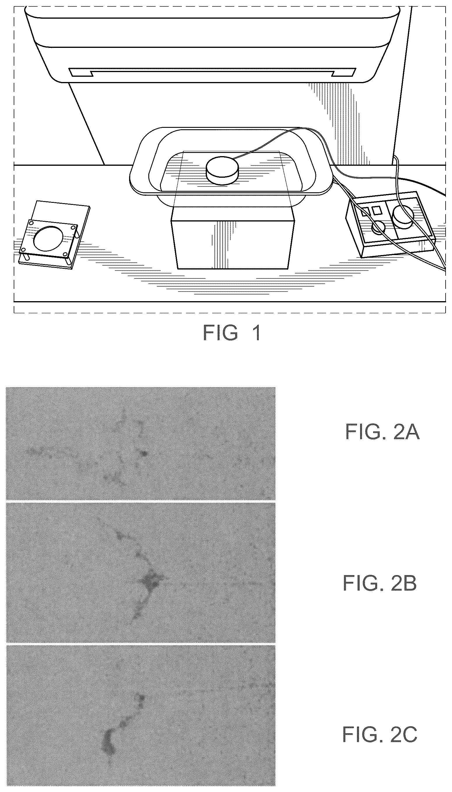 Patent US12376863 — Embolic compositions — Figure 1