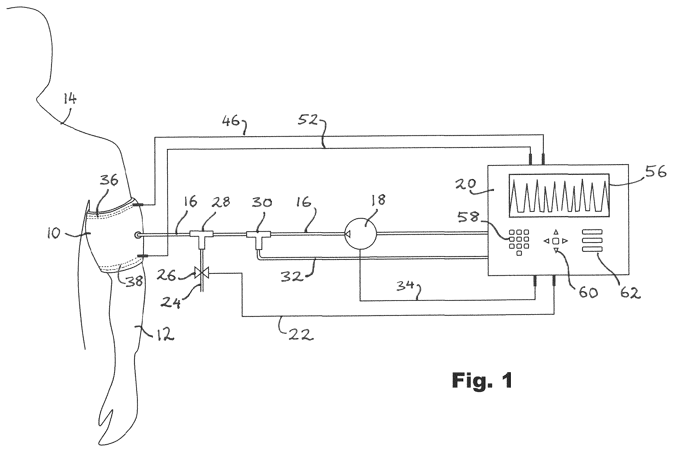 Patent US12376865 — Tourniquet assemblies and systems, and methods for controlling tourniquets — Figure 1